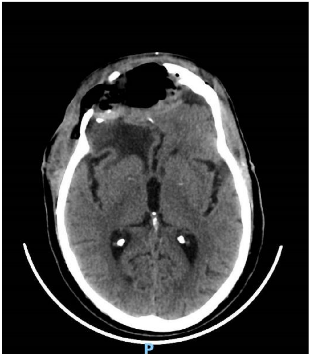 Brainsci 11 01076 g005 Brainsci 11 01076 g005