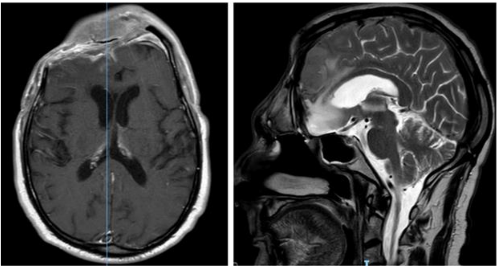 Brainsci 11 01076 g006 Brainsci 11 01076 g006