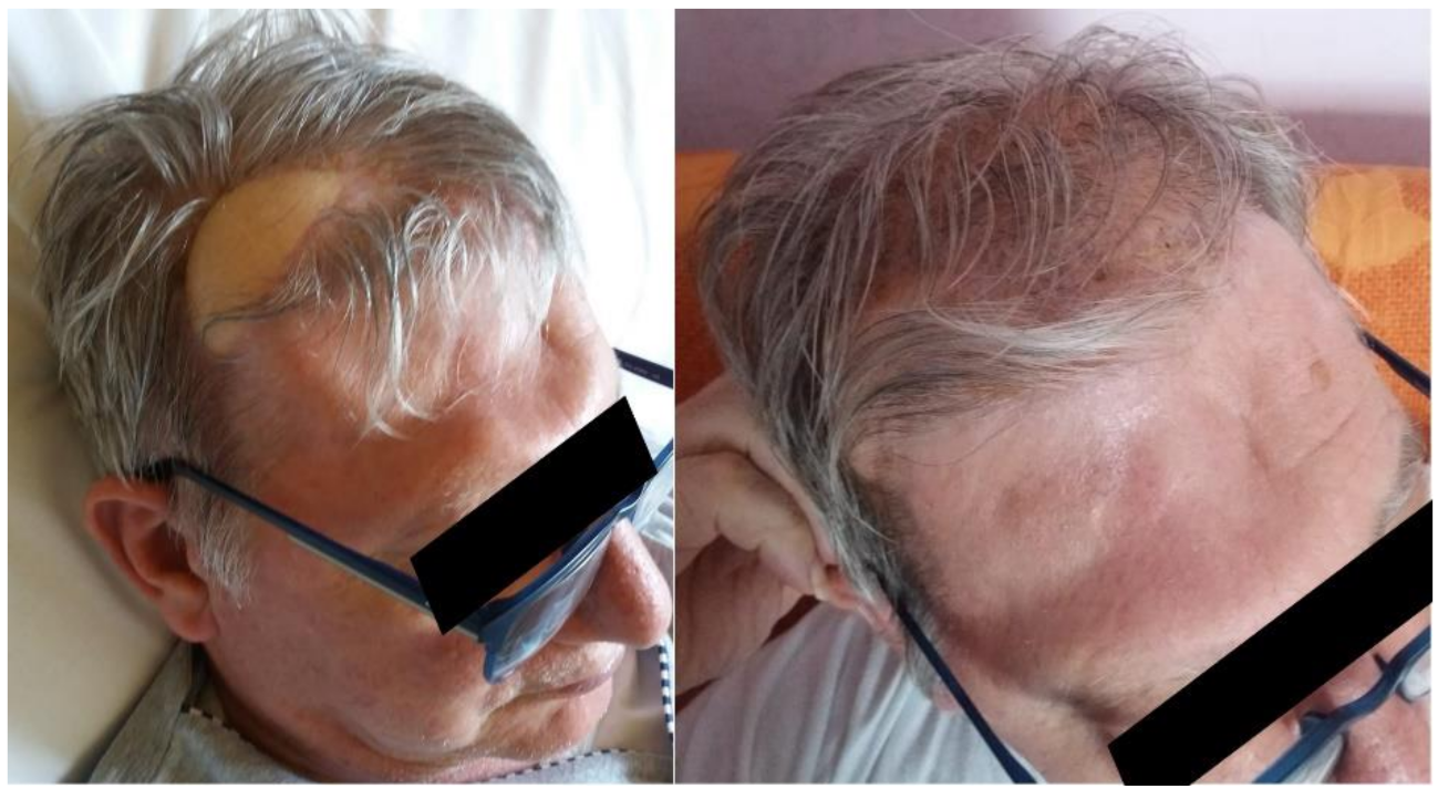 Brainsci 11 01076 g008 Brainsci 11 01076 g008