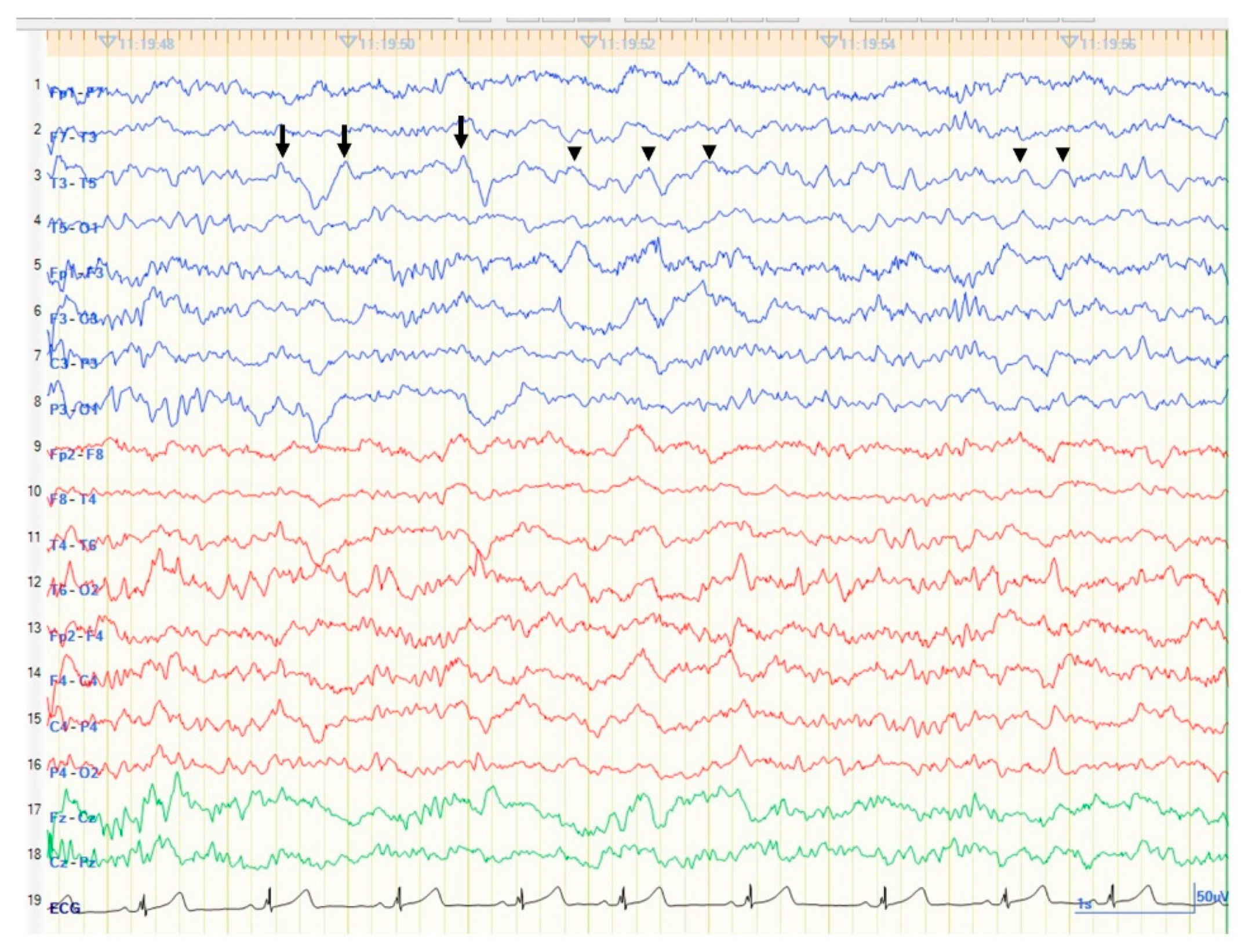 Brainsci 11 01136 g001