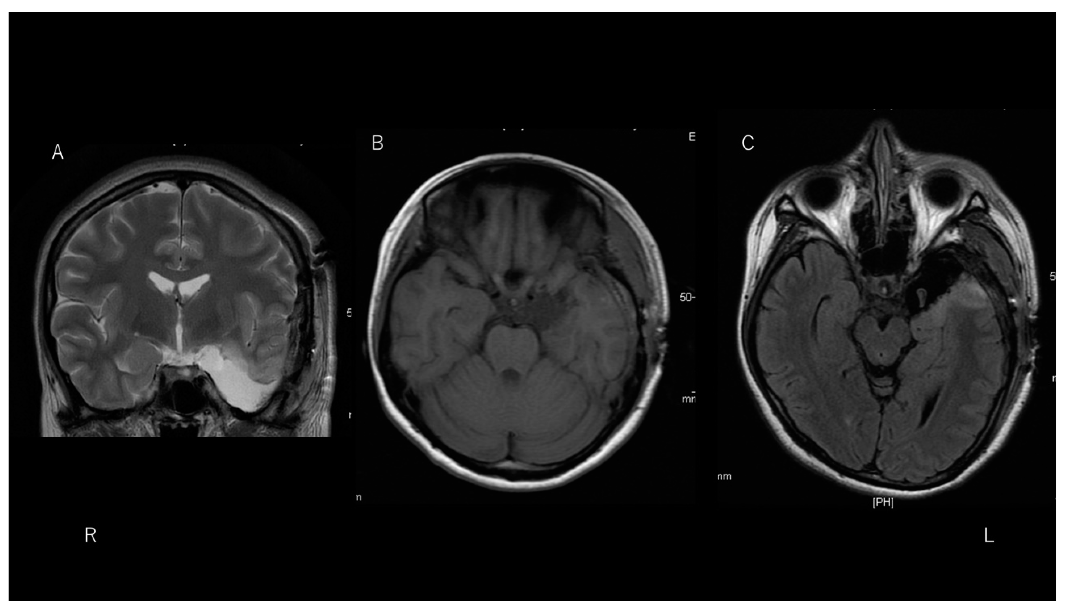 Brainsci 11 01136 g004