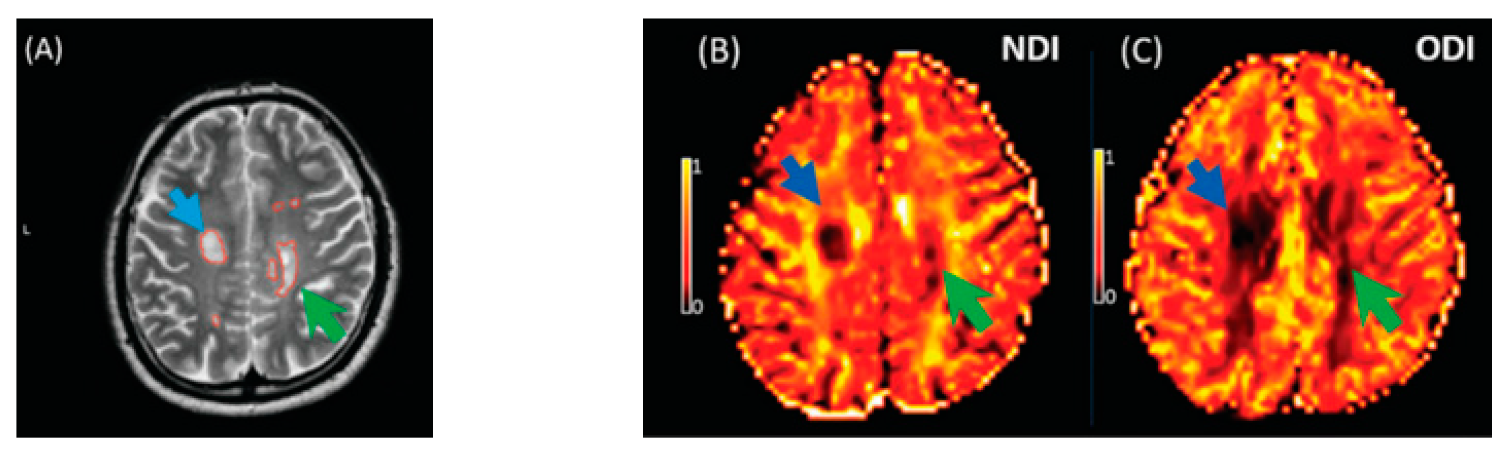 Brainsci 11 01151 g008 Brainsci 11 01151 g008