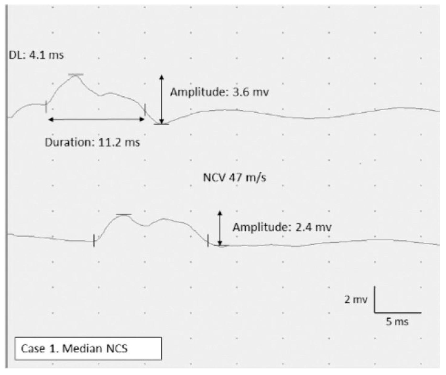 Brainsci 11 01177 g002