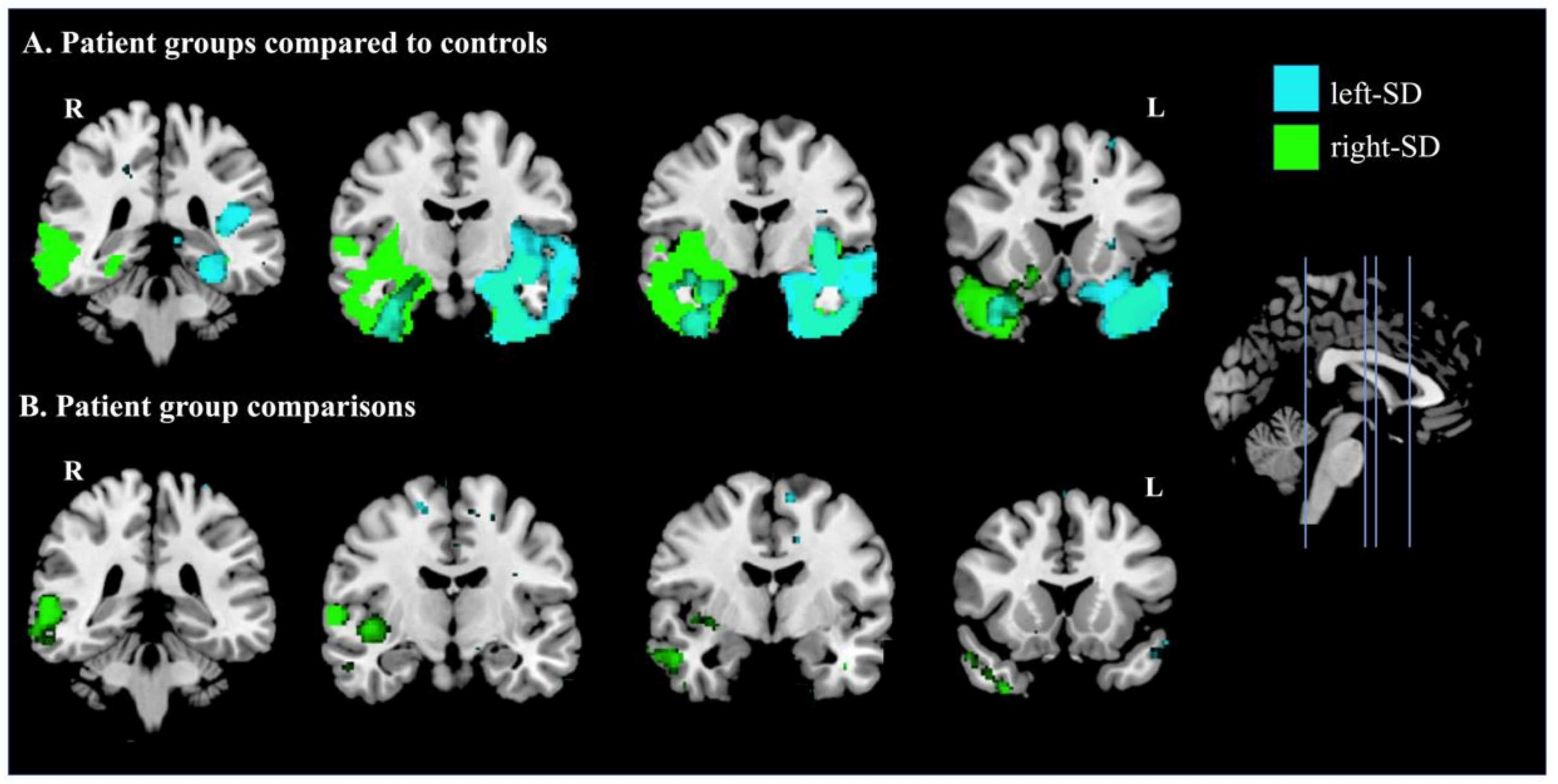 Brainsci 11 01195 g005 Brainsci 11 01195 g005
