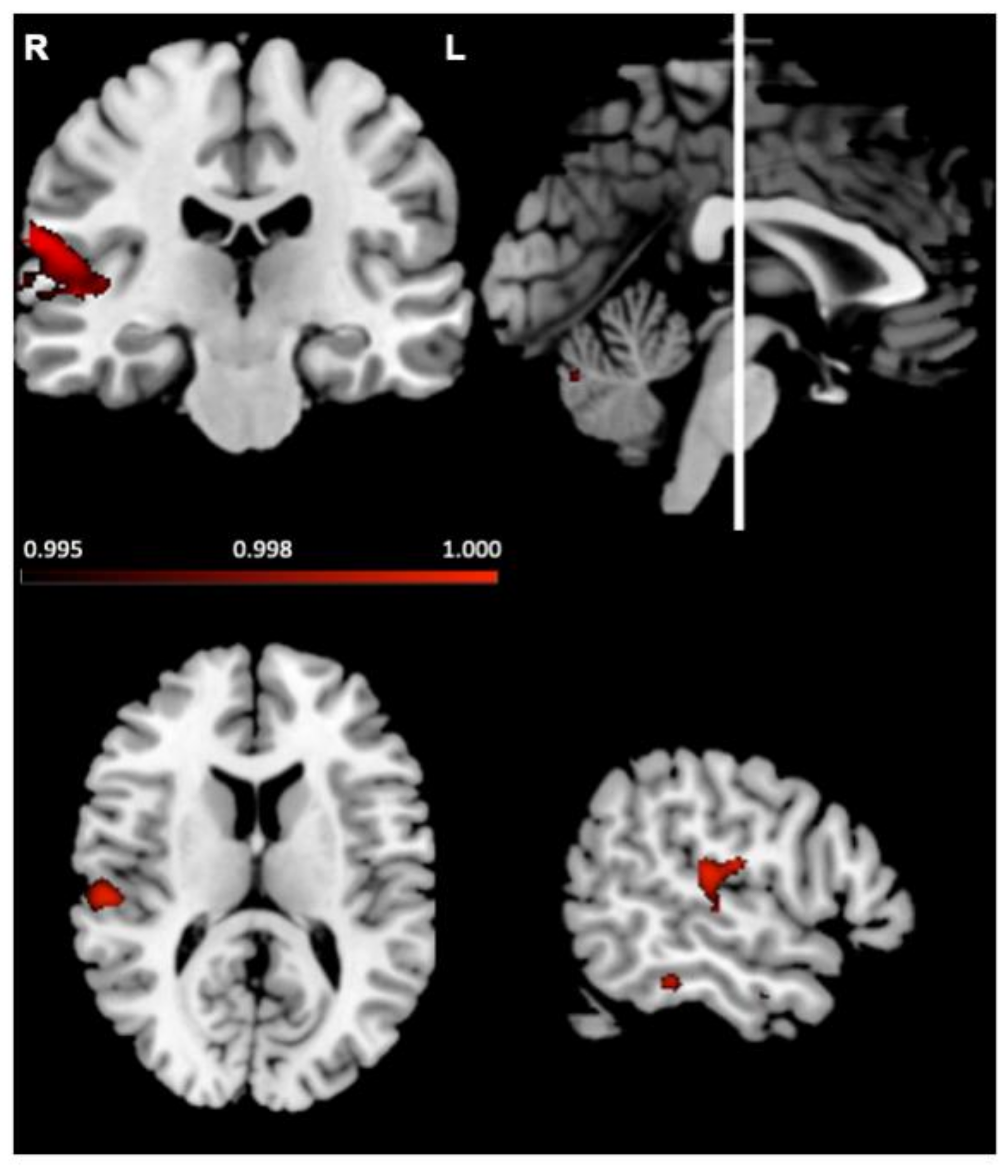 Brainsci 11 01195 g006 Brainsci 11 01195 g006