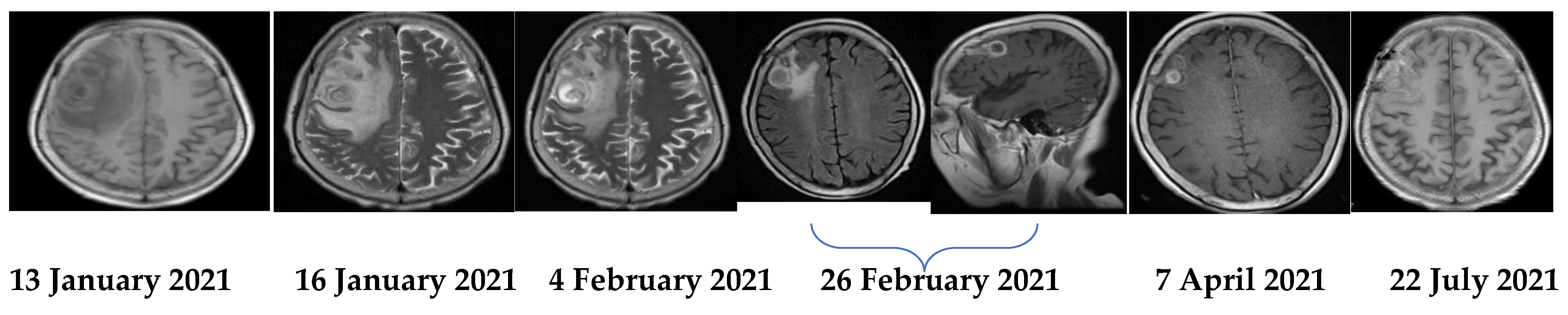 Brainsci 11 01204 g003