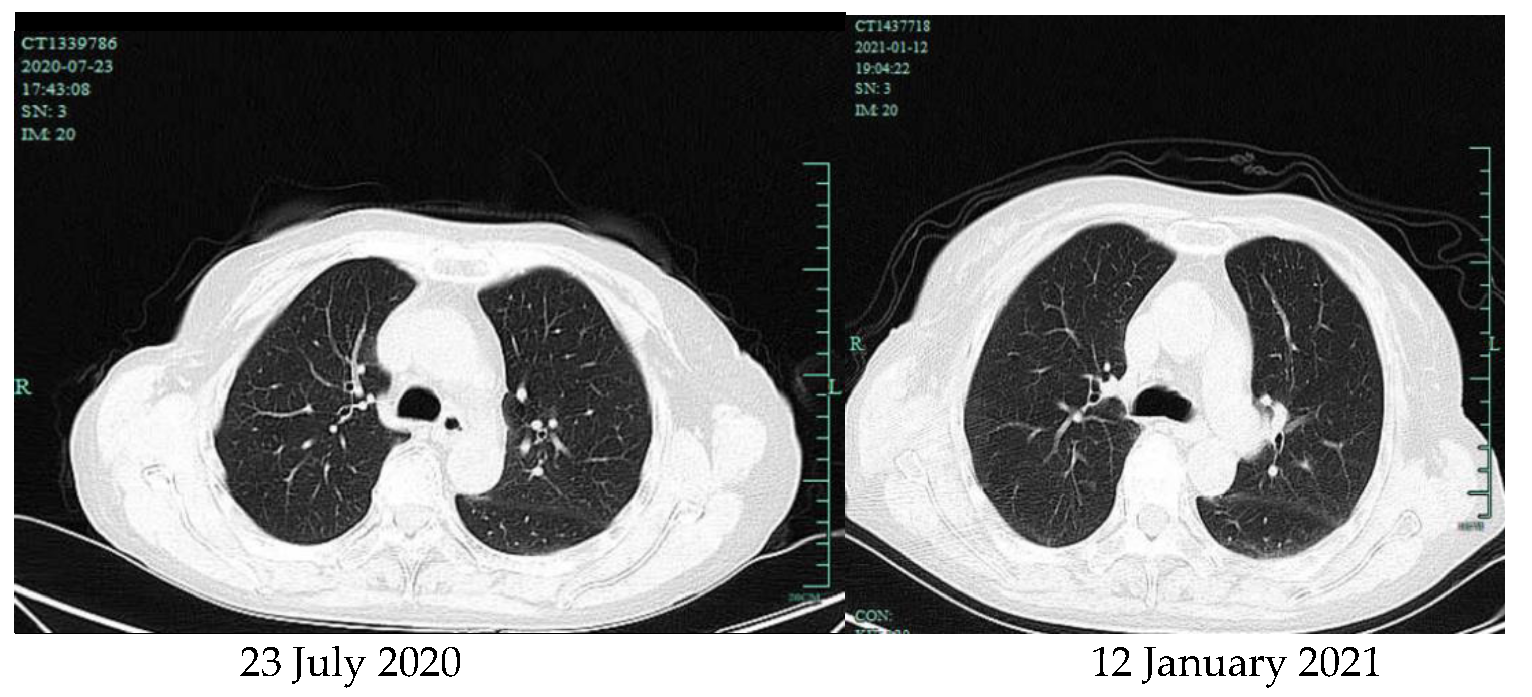 Brainsci 11 01204 g004