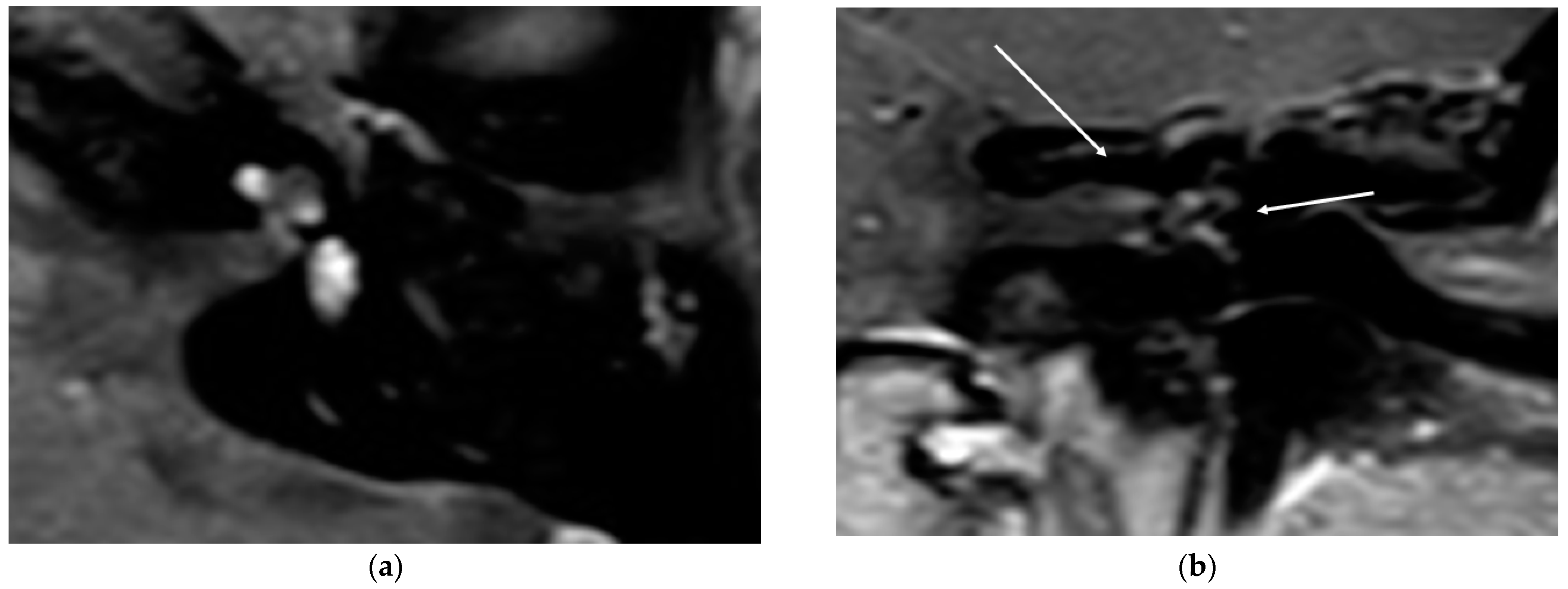 Brainsci 11 01221 g004