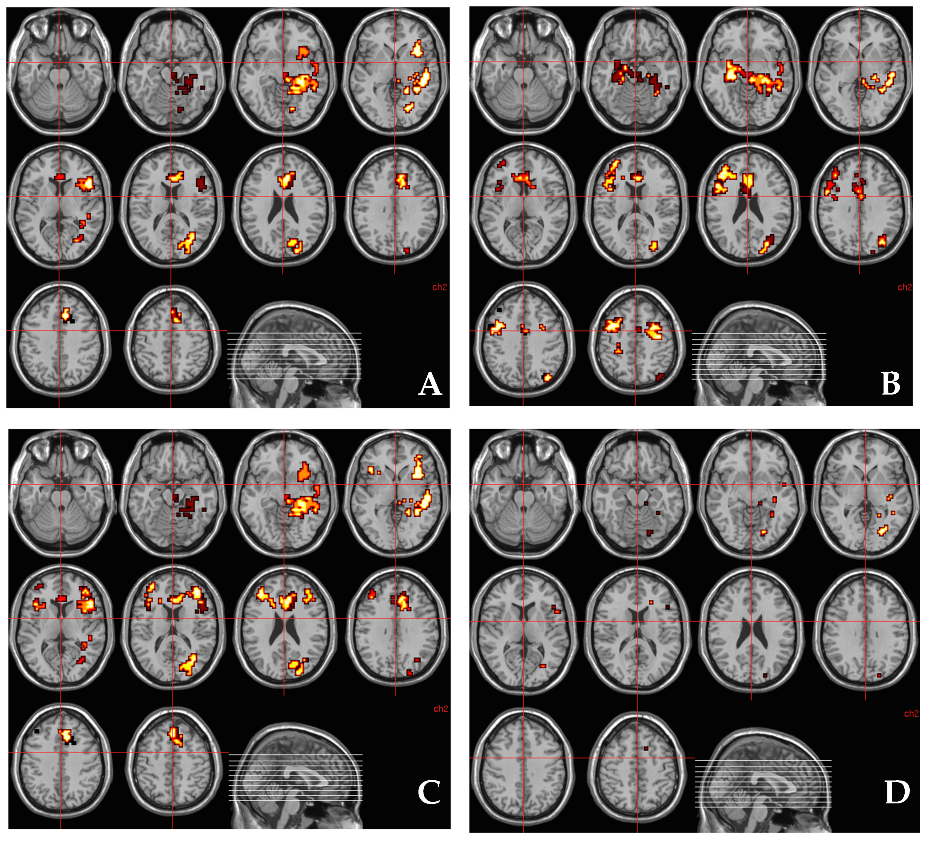 Brainsci 11 01240 g002