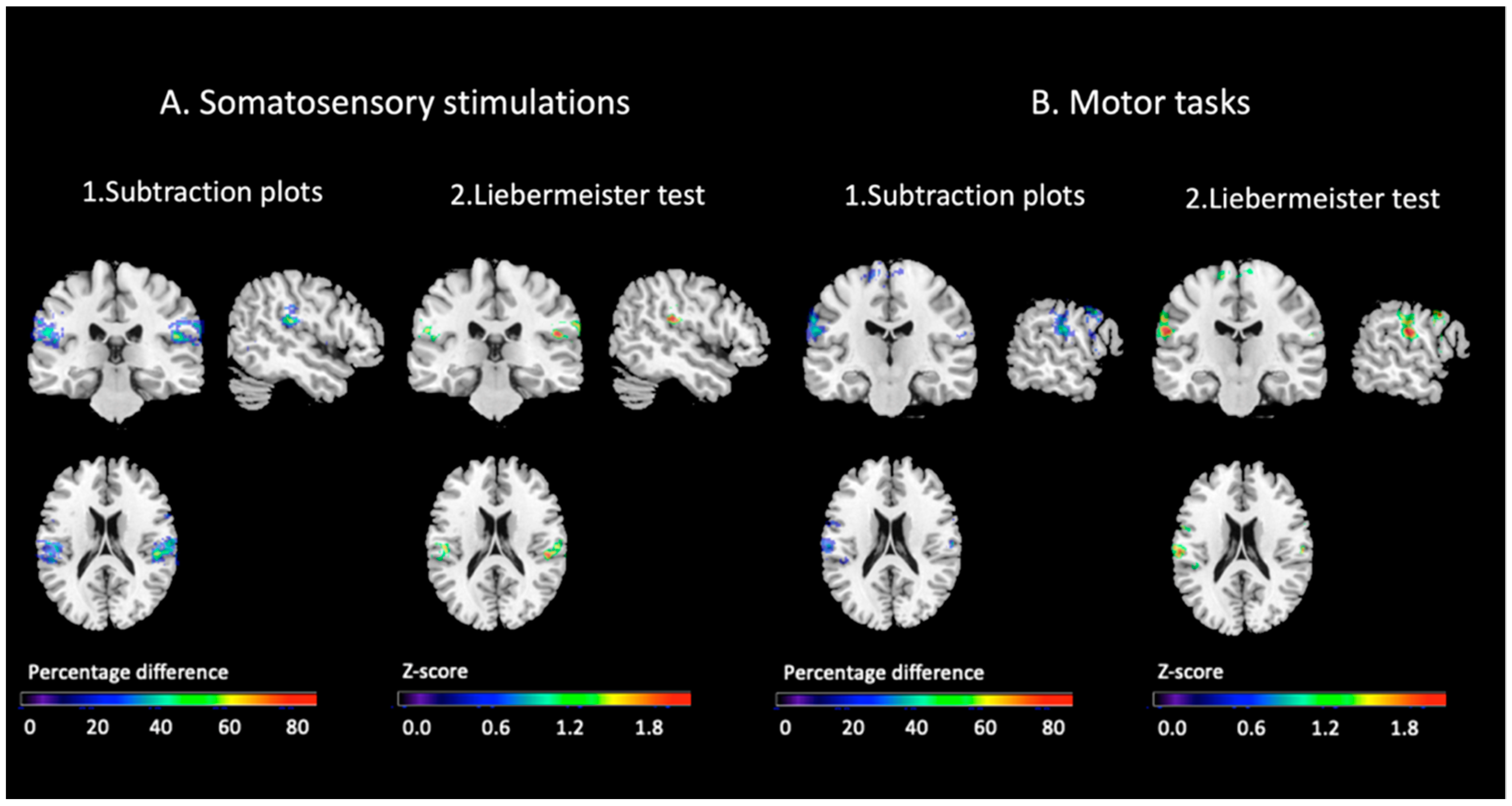 Brainsci 11 01248 g004