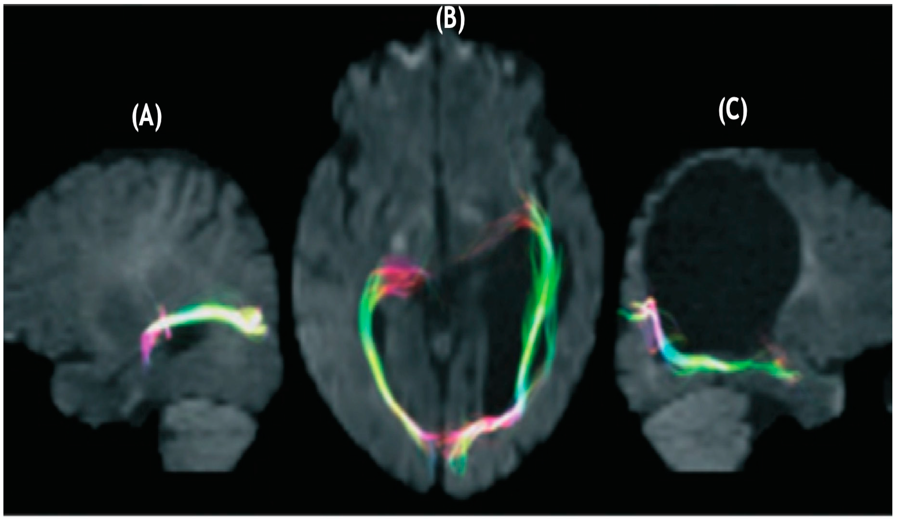 Brainsci 11 01279 g001 Brainsci 11 01279 g001