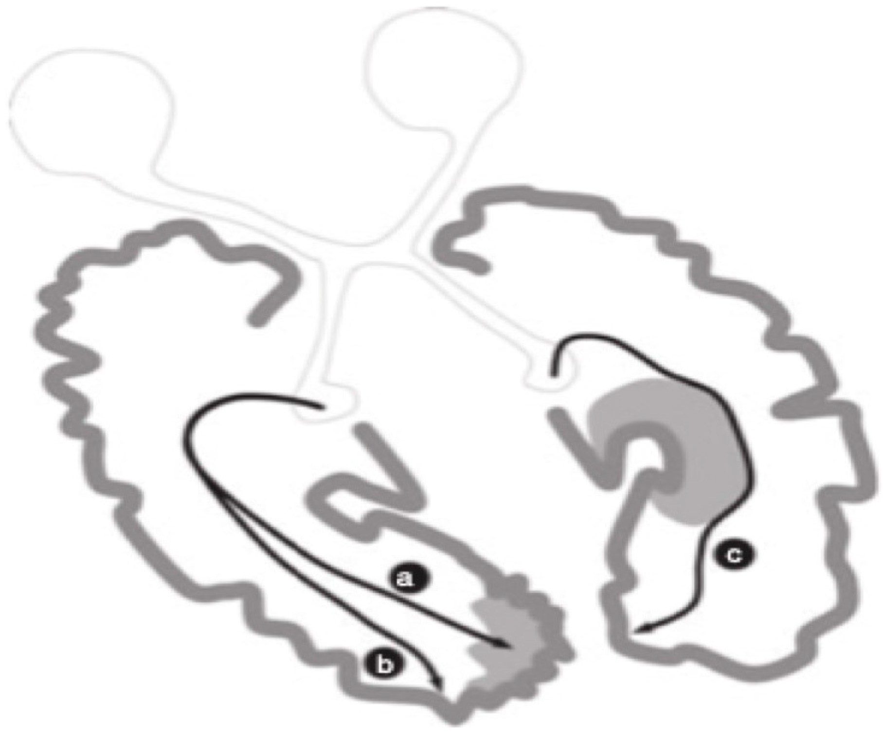 Brainsci 11 01279 g003 Brainsci 11 01279 g003