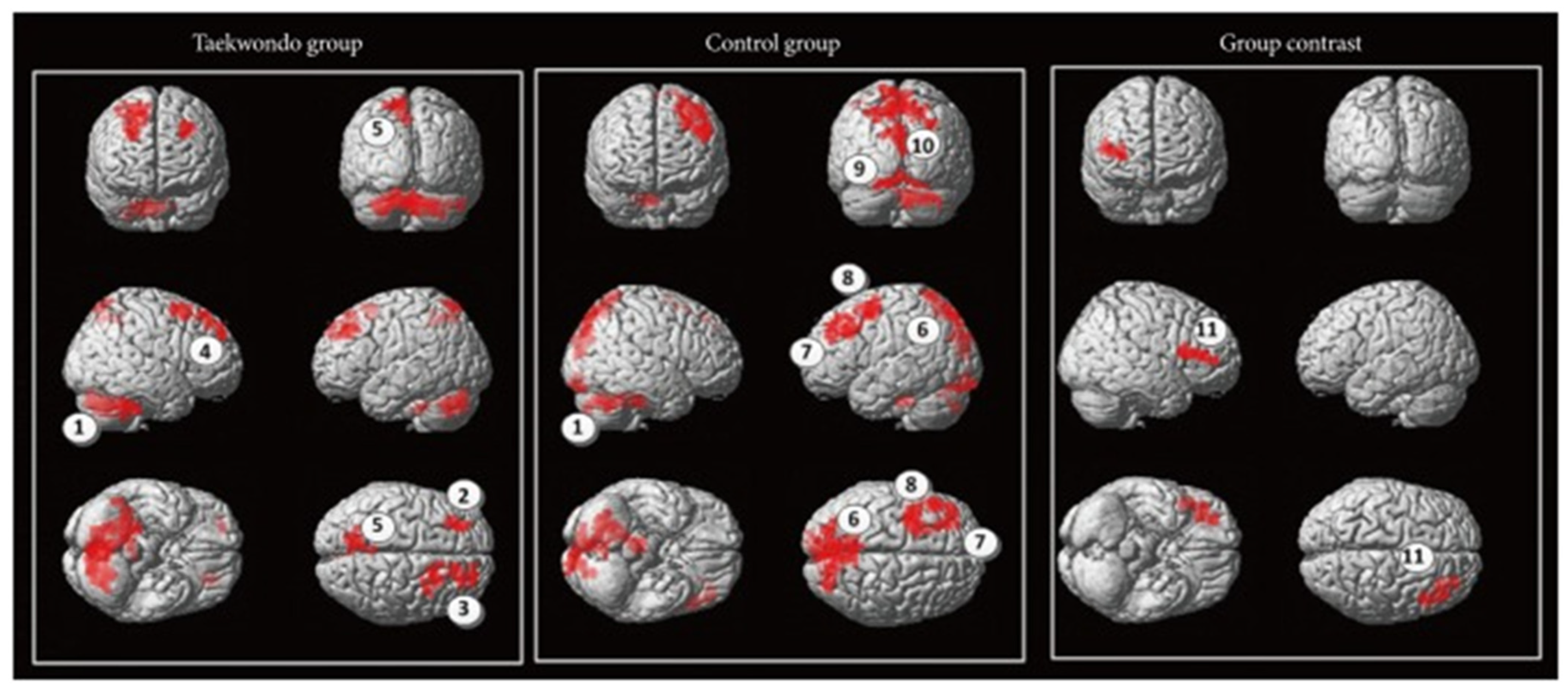 Brainsci 11 01289 g001