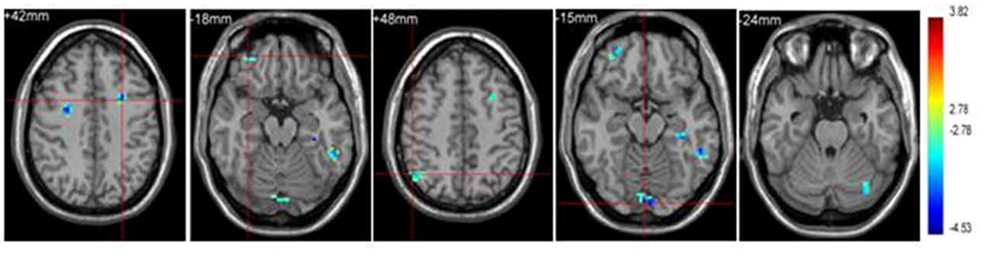 Brainsci 11 01289 g004