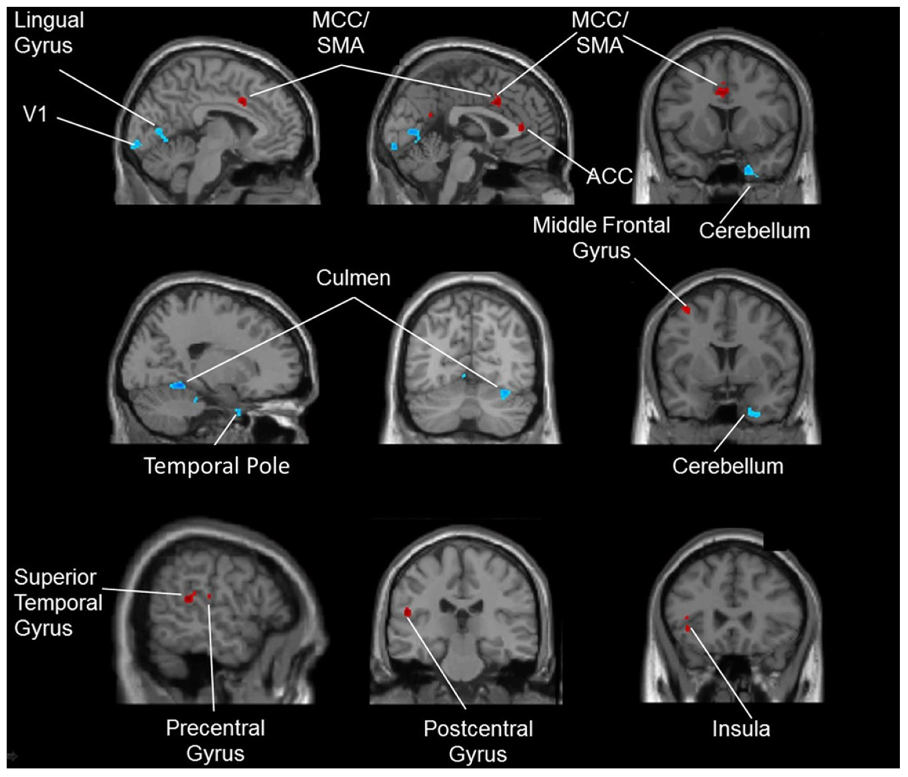 Brainsci 11 01289 g005