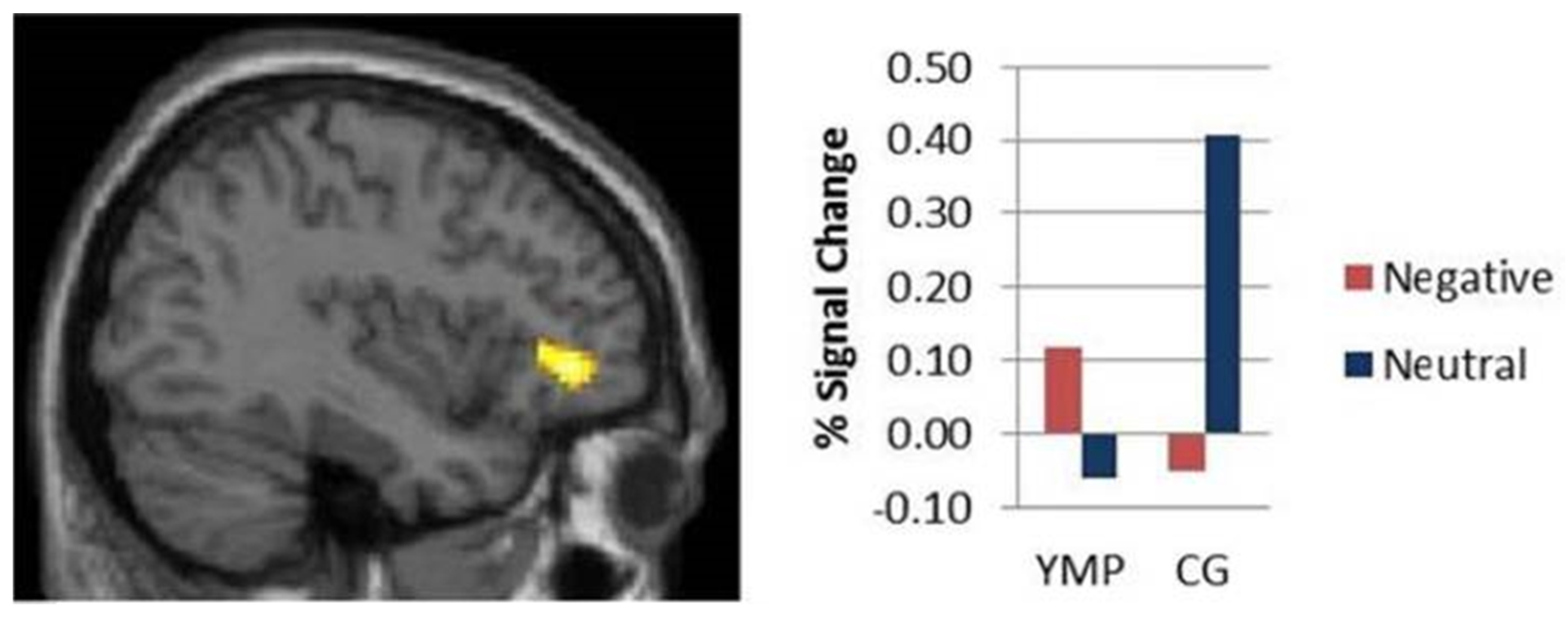 Brainsci 11 01289 g006