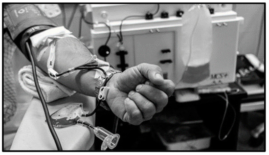 Brainsci 11 01489 g0a7