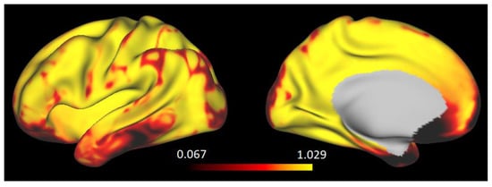 Brainsci 11 01565 g0a2 550
