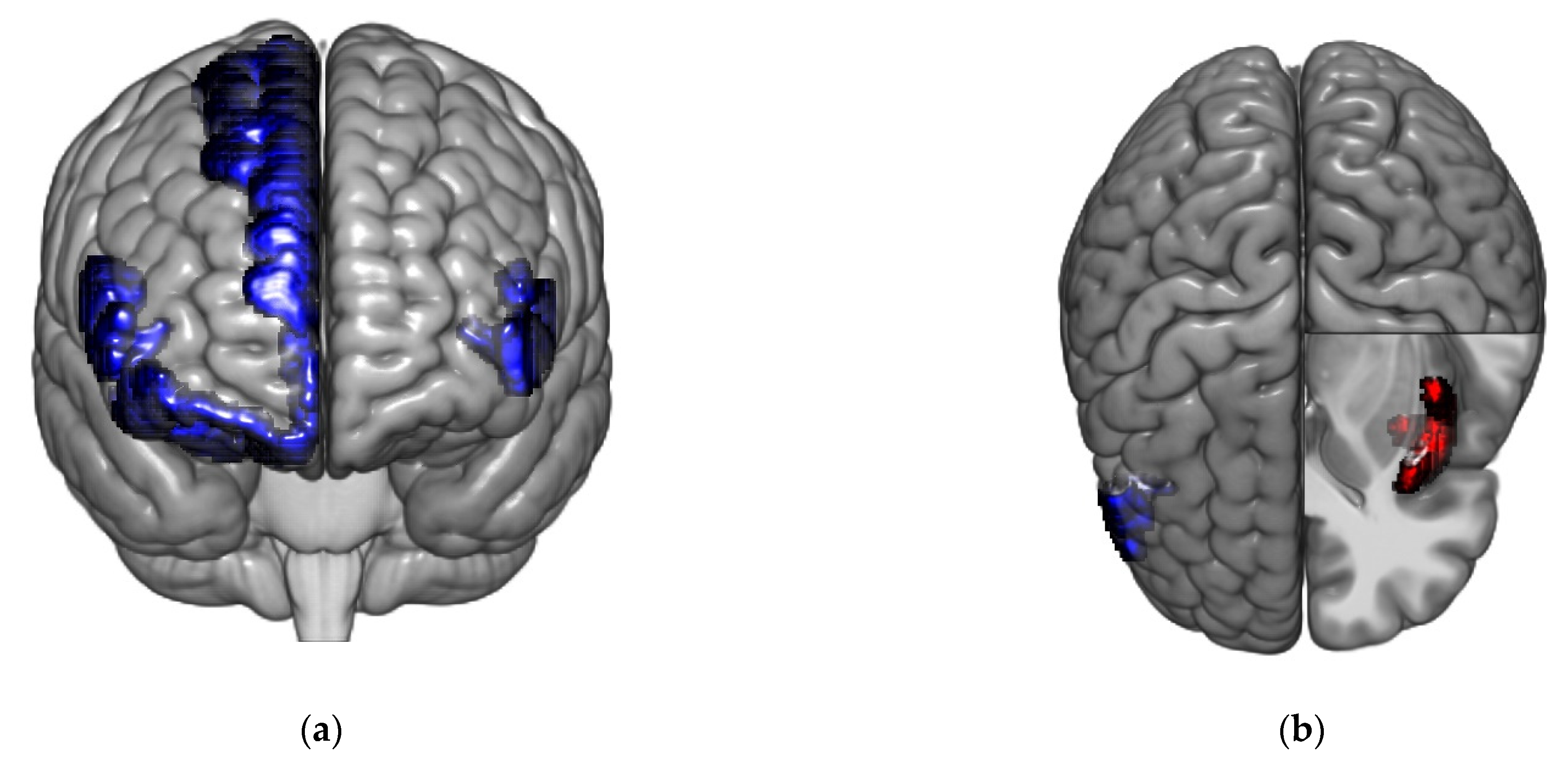 Brainsci 11 01580 g003
