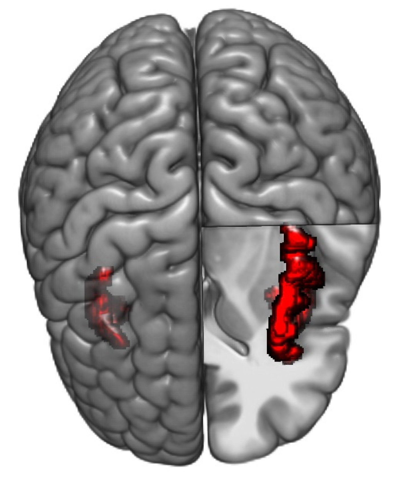 Brainsci 11 01580 g004