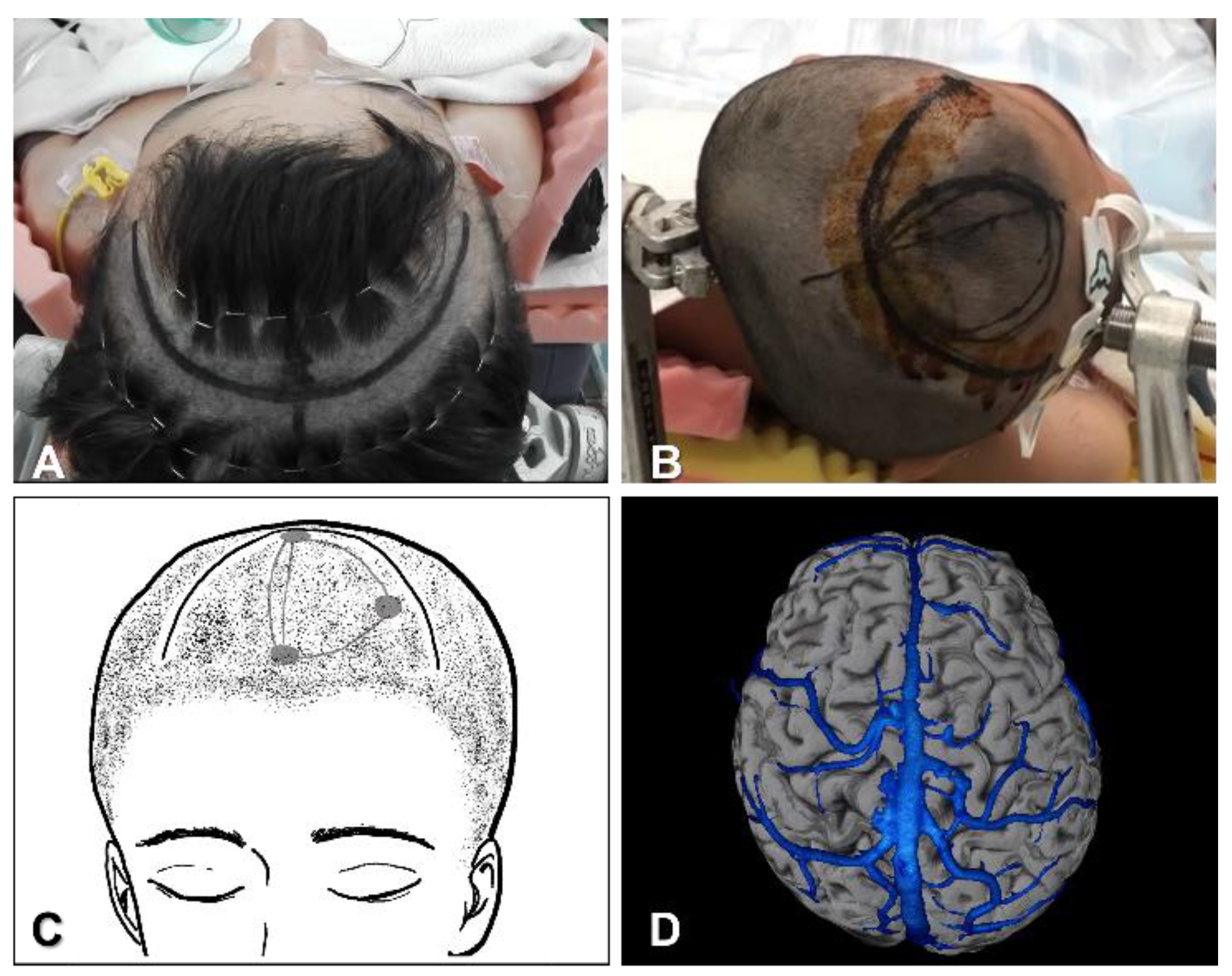 Brainsci 11 01608 g001 Brainsci 11 01608 g001