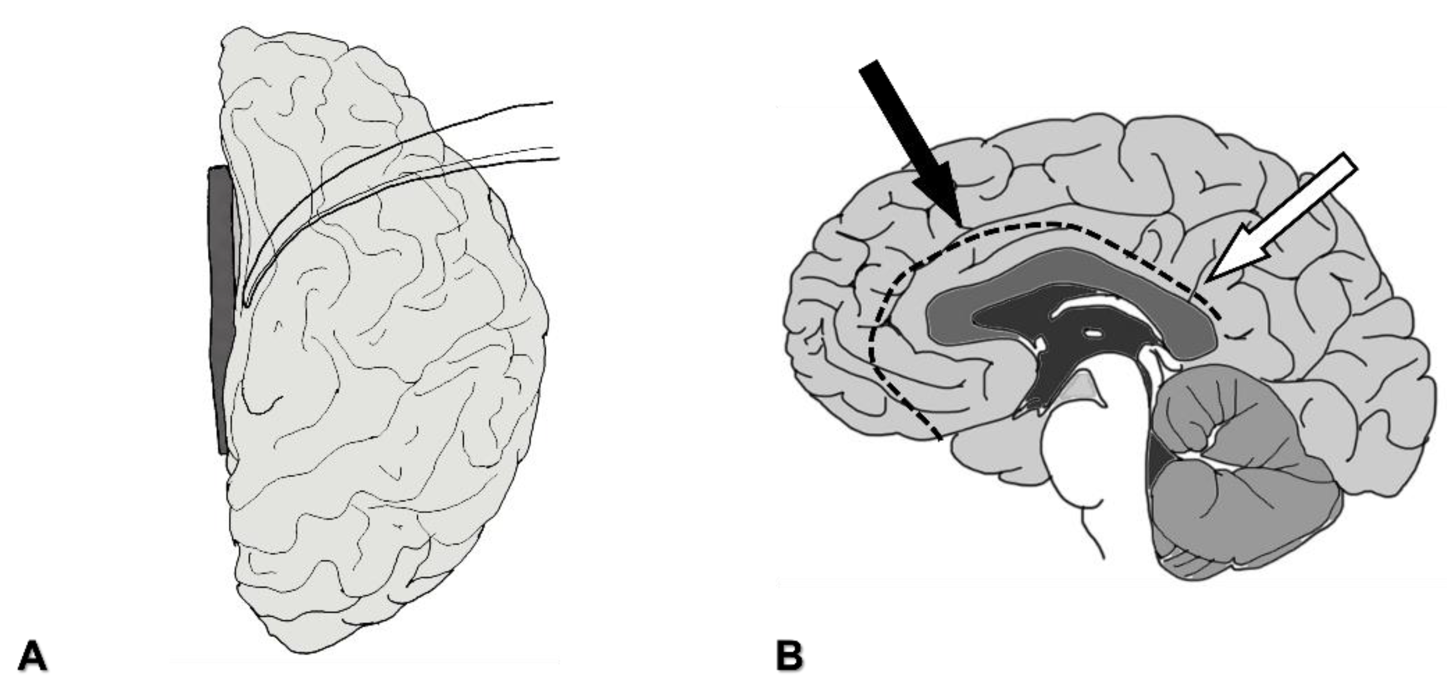 Brainsci 11 01608 g002 Brainsci 11 01608 g002