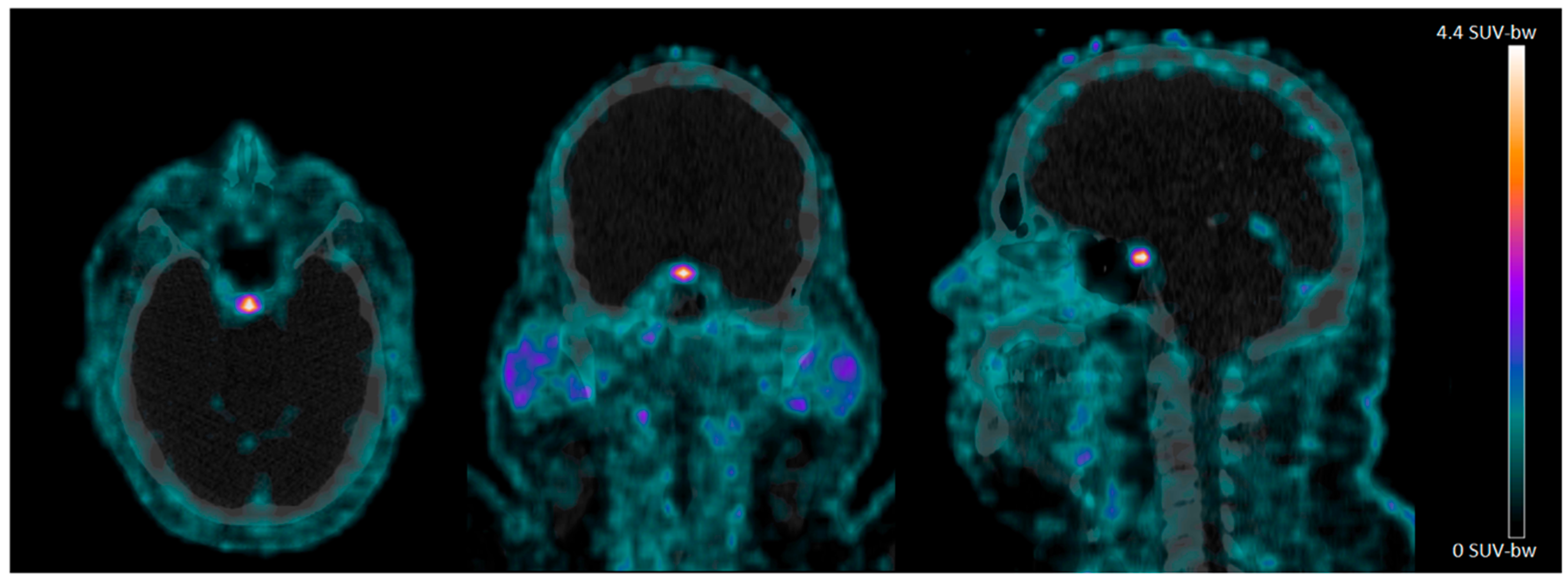 Brainsci 11 01647 g001