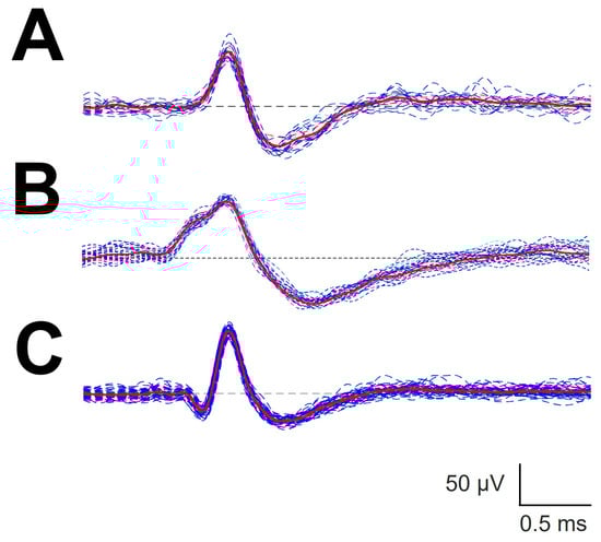 Brainsci 12 00043 g0a1