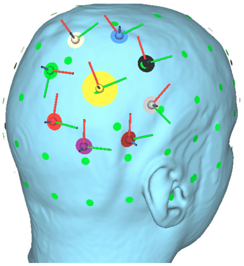 Brainsci 12 00071 g0a1 550