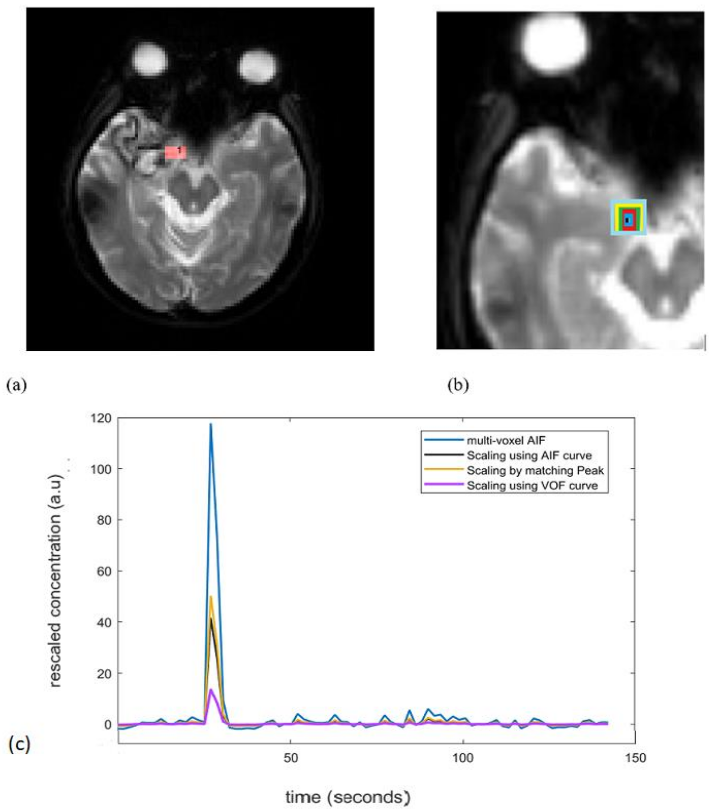 Brainsci 12 00077 g002