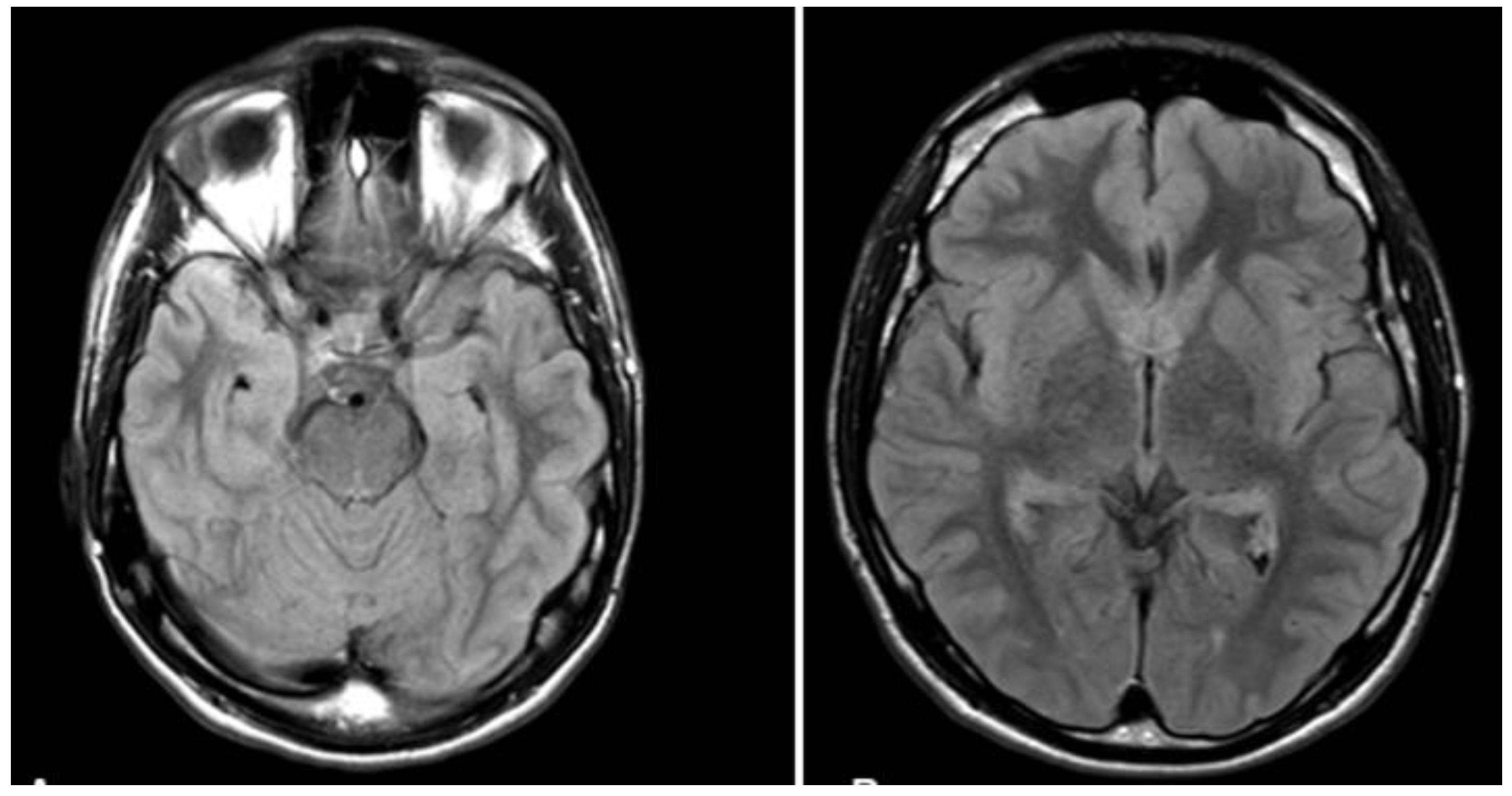 Brainsci 12 00115 g001