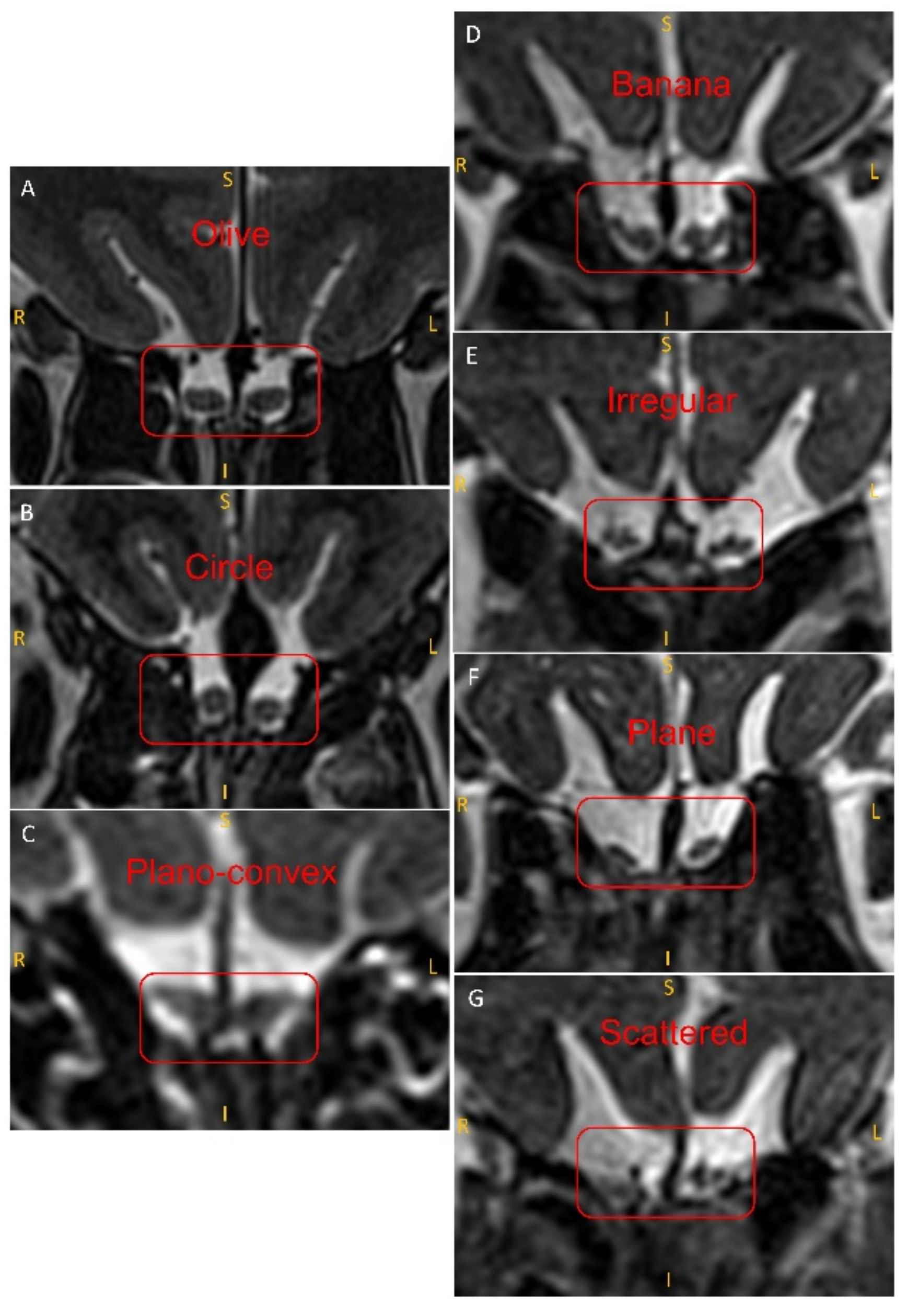 Brainsci 12 00128 g002