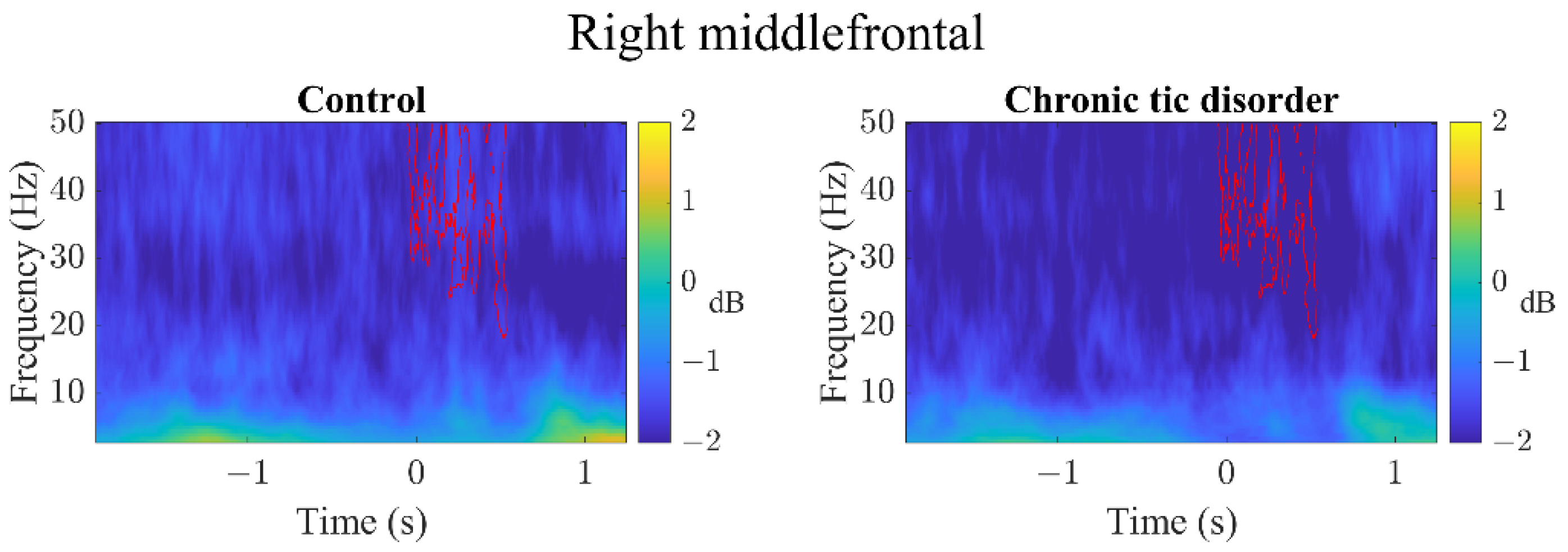 Brainsci 12 00151 g003
