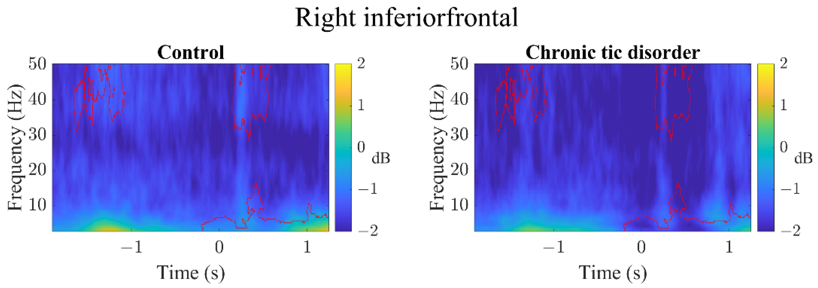 Brainsci 12 00151 g004