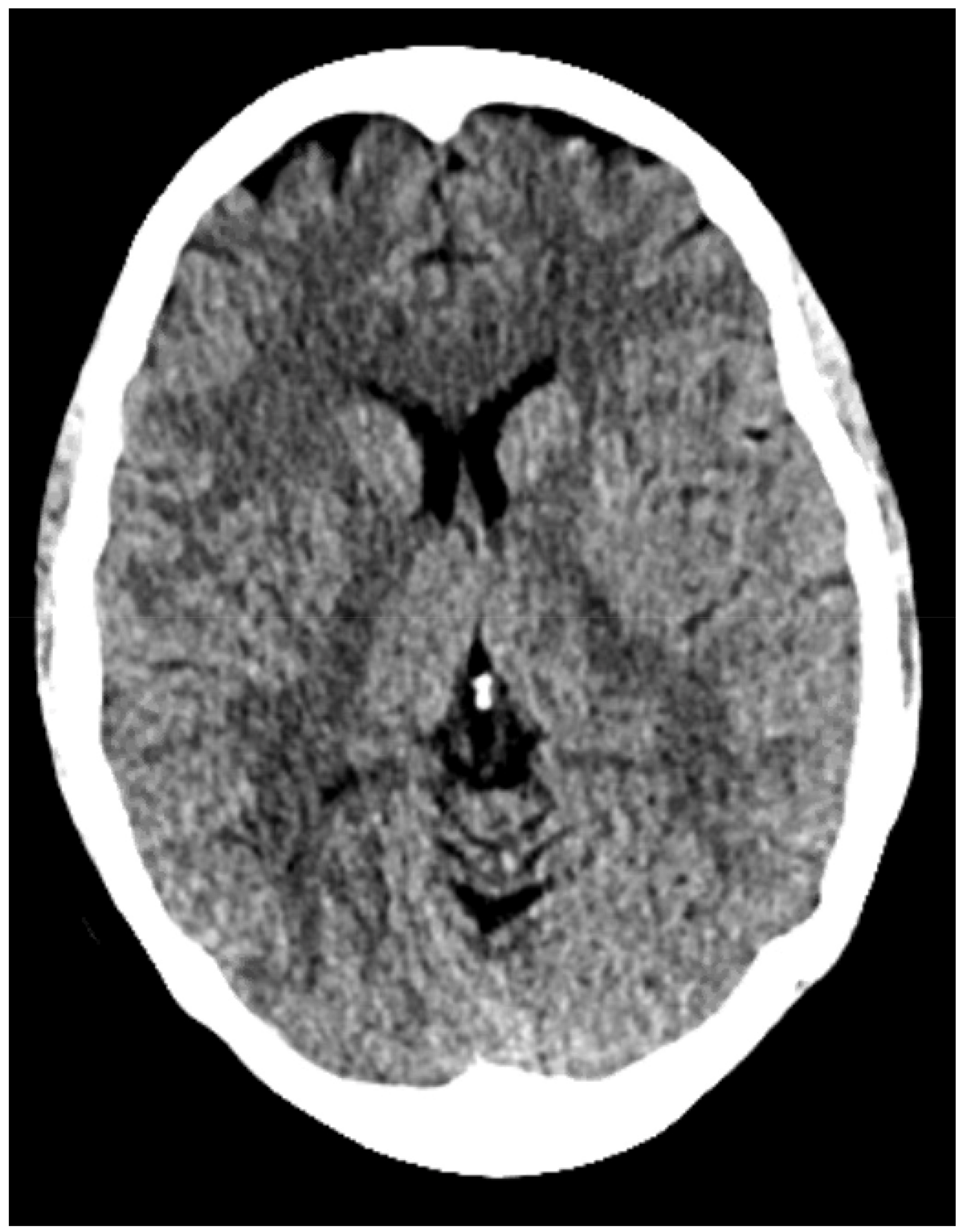 Brainsci 12 00152 g001