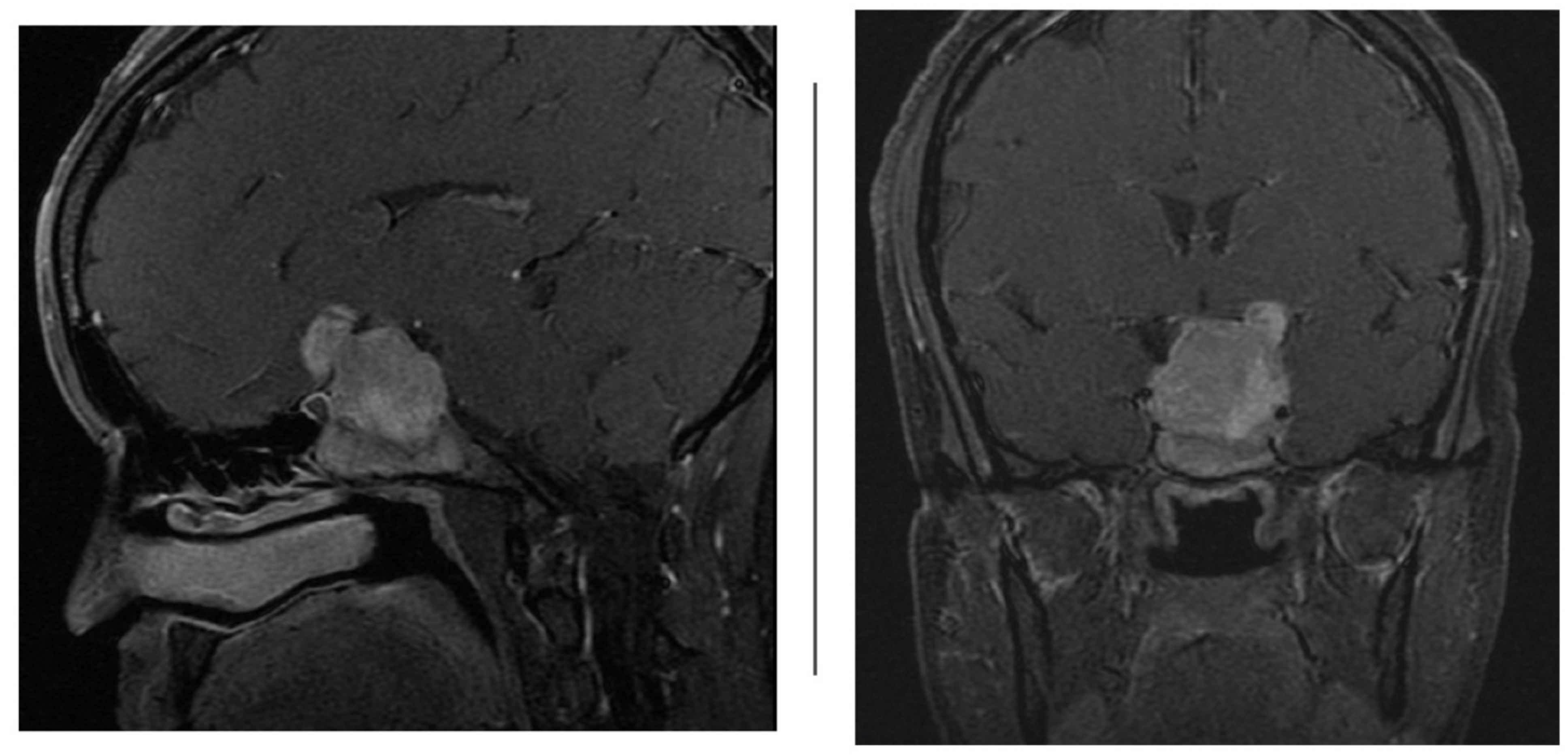 Brainsci 12 00152 g002