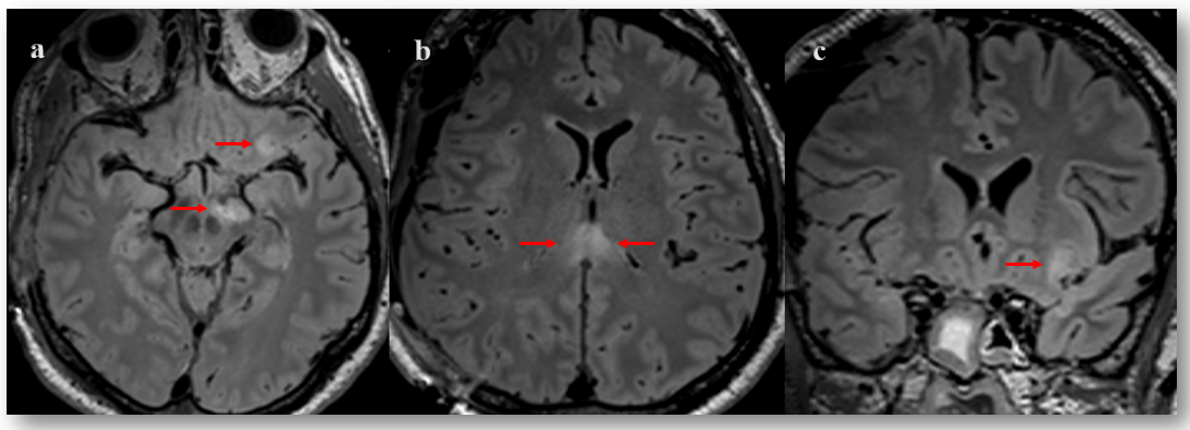 Brainsci 12 00157 g002