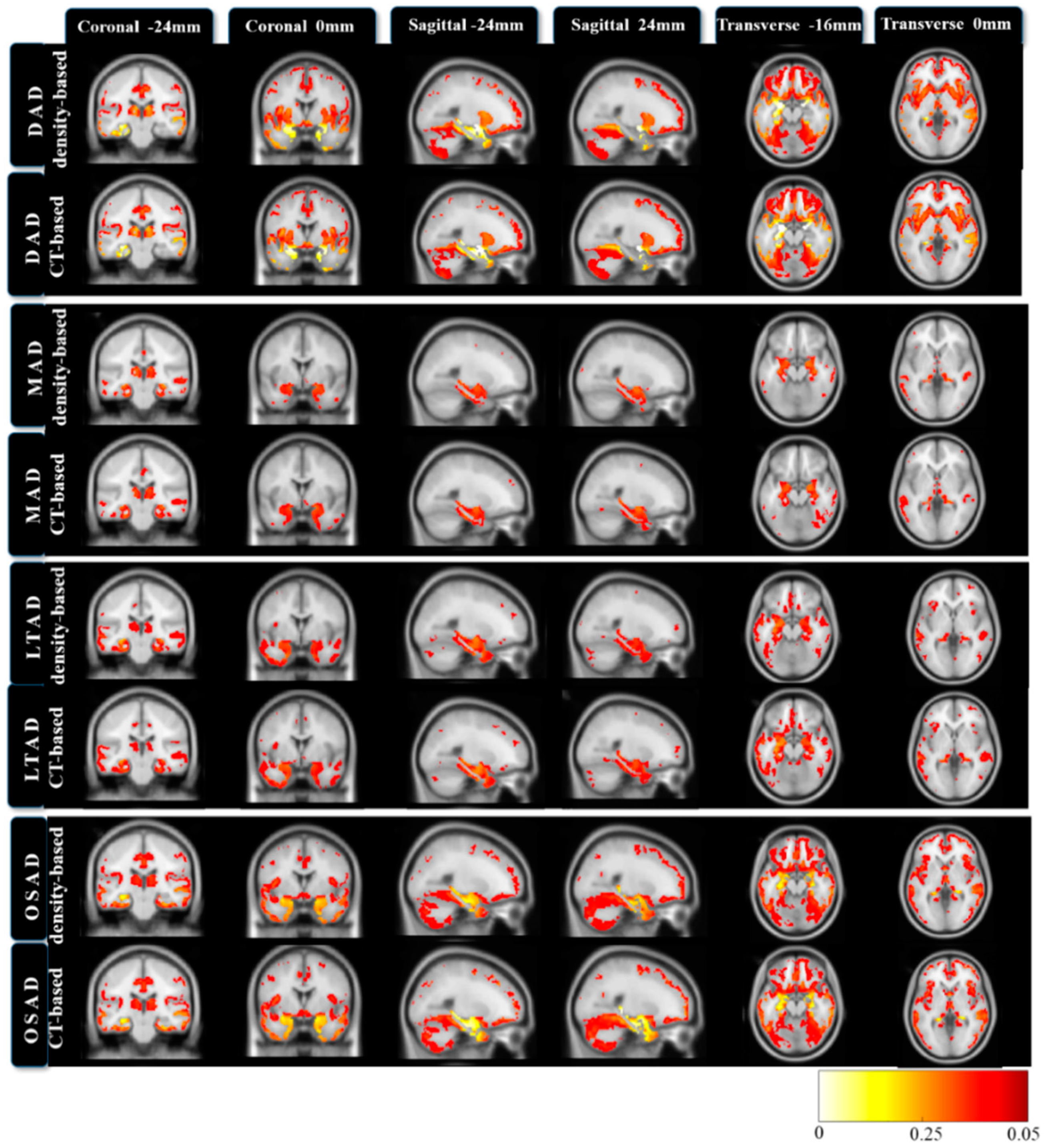 Brainsci 12 00187 g004