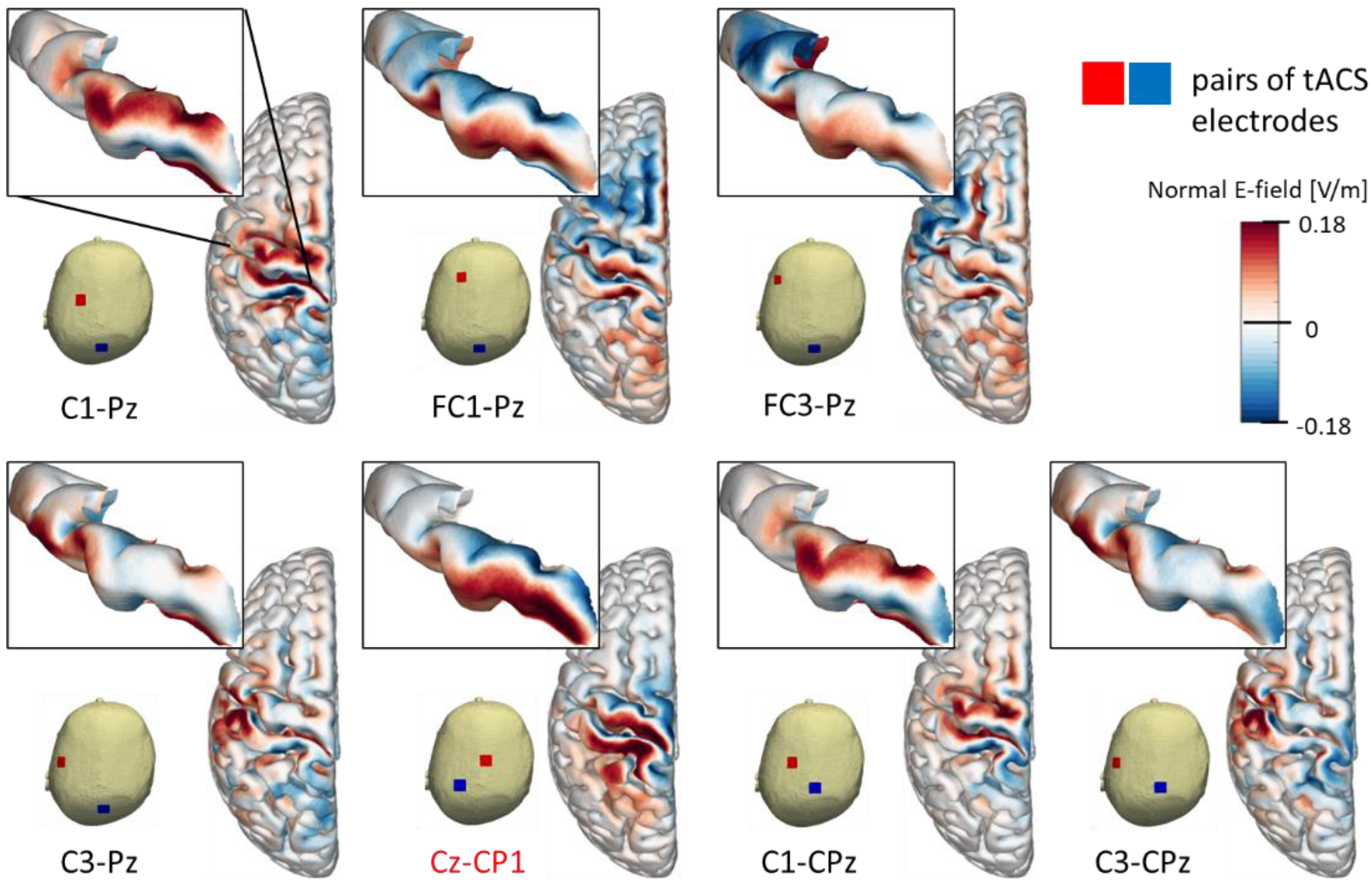 Brainsci 12 00195 g004