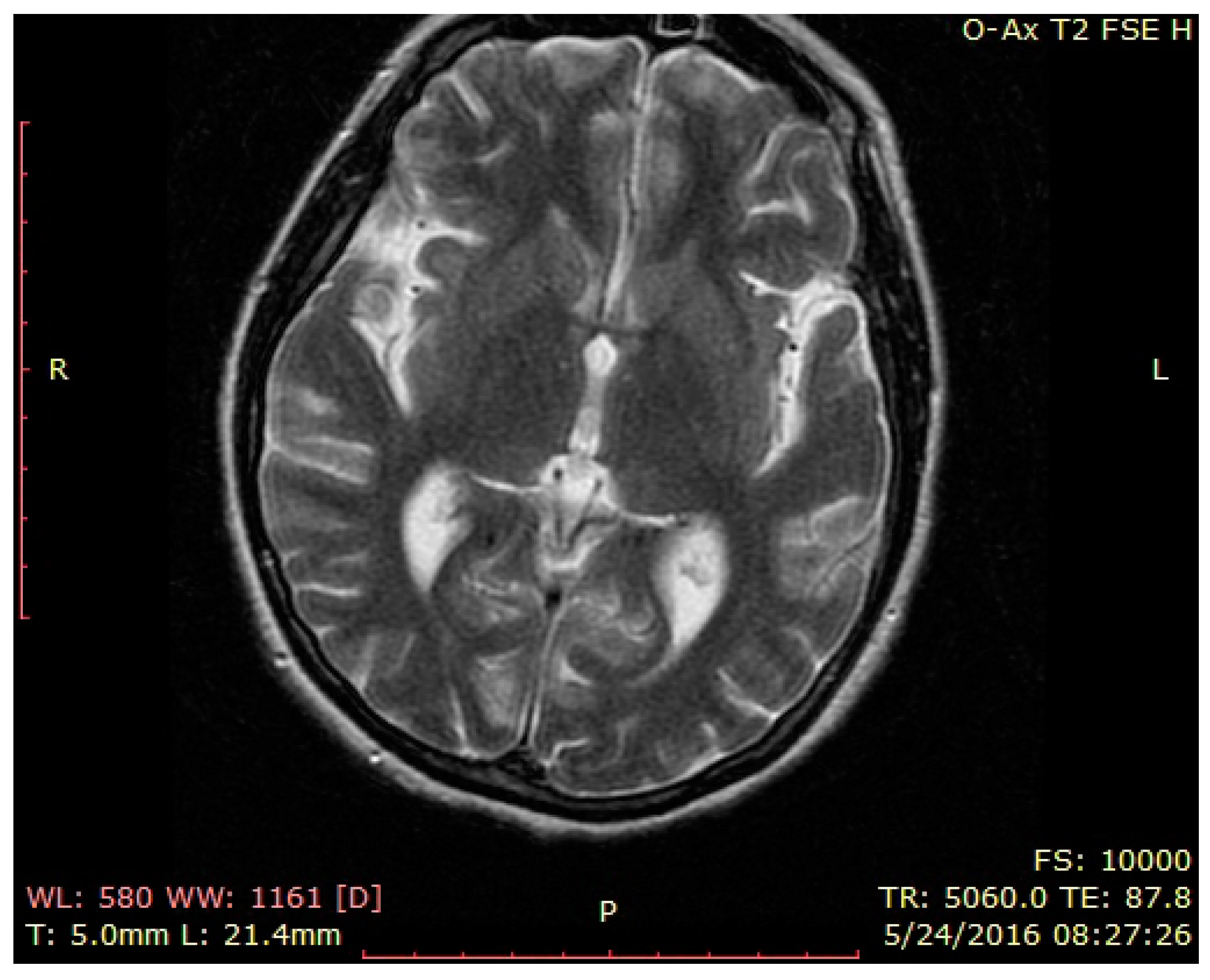 Brainsci 12 00221 g002