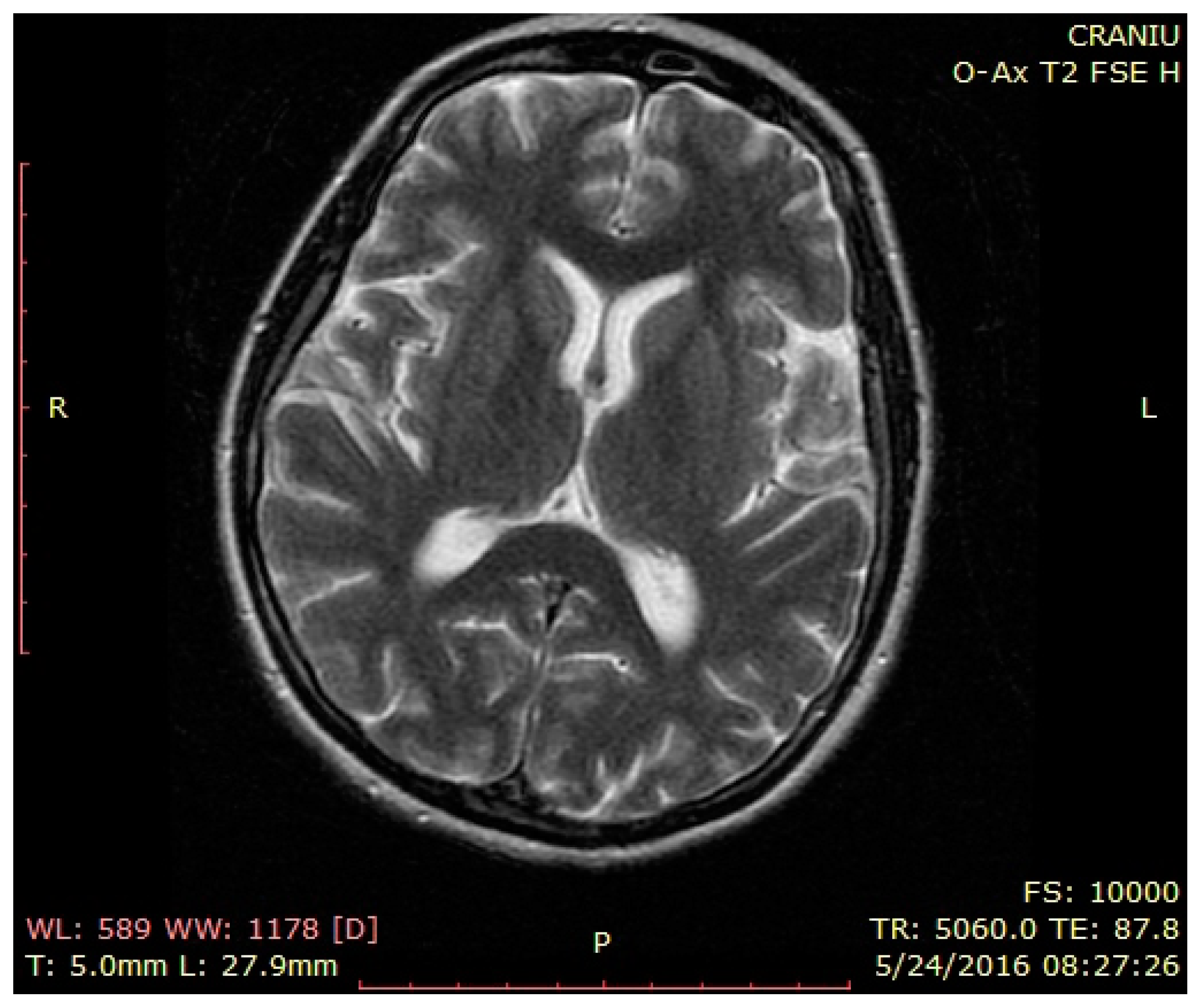 Brainsci 12 00221 g003