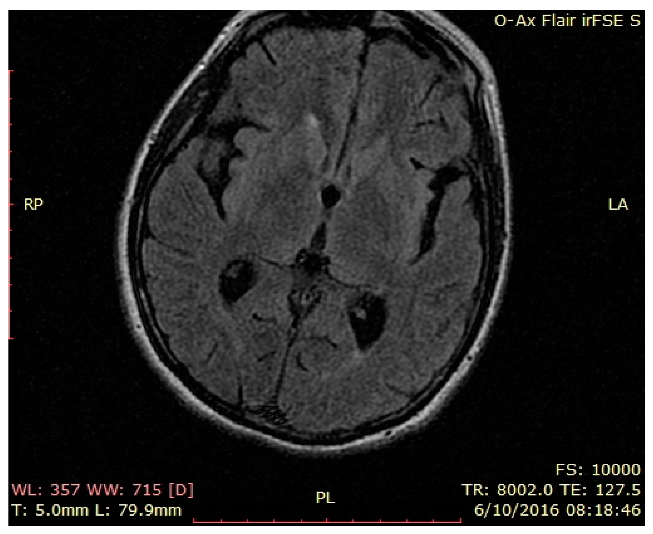 Brainsci 12 00221 g005
