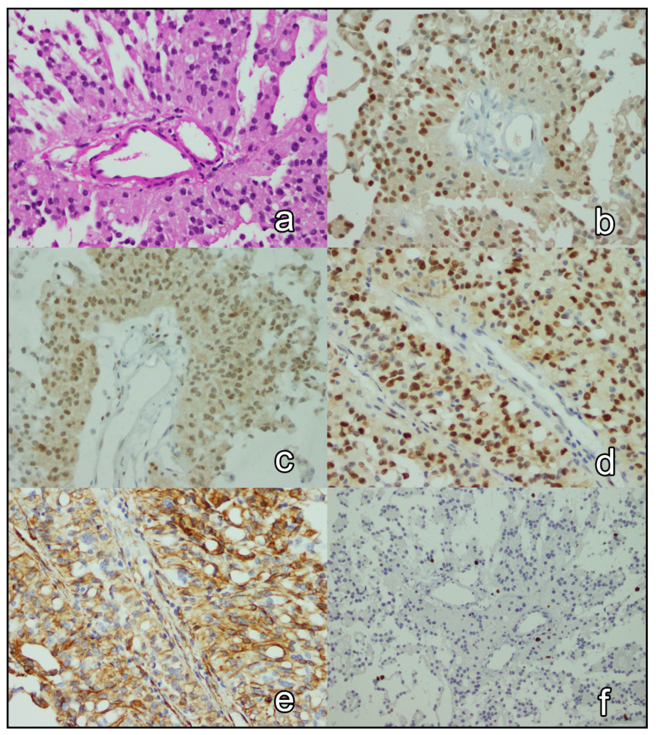 Brainsci 12 00282 g001