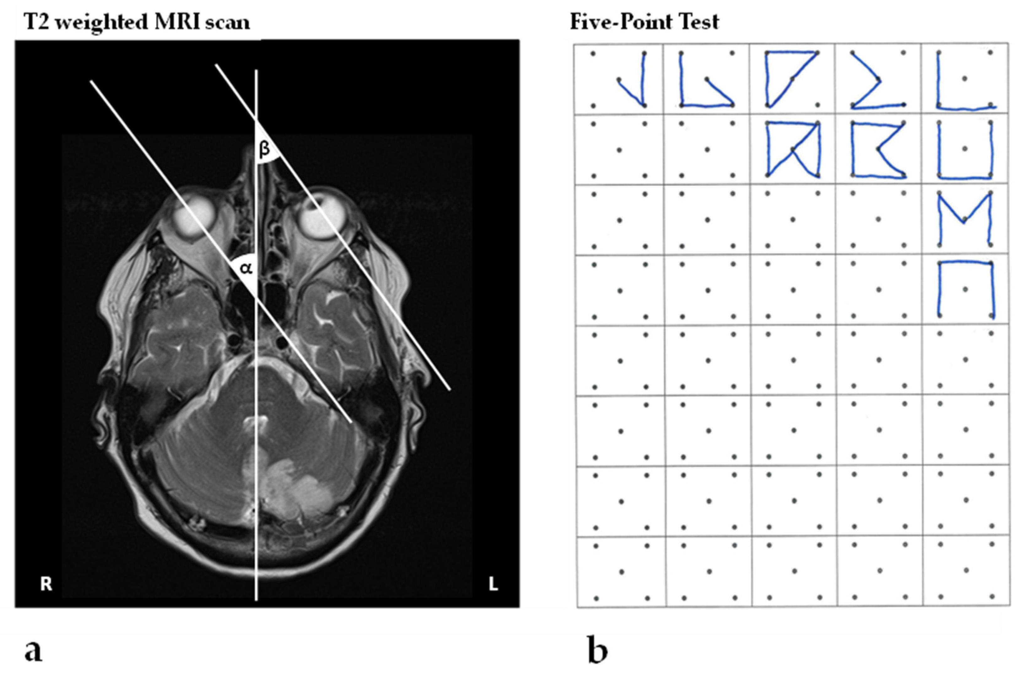 Brainsci 12 00290 g001