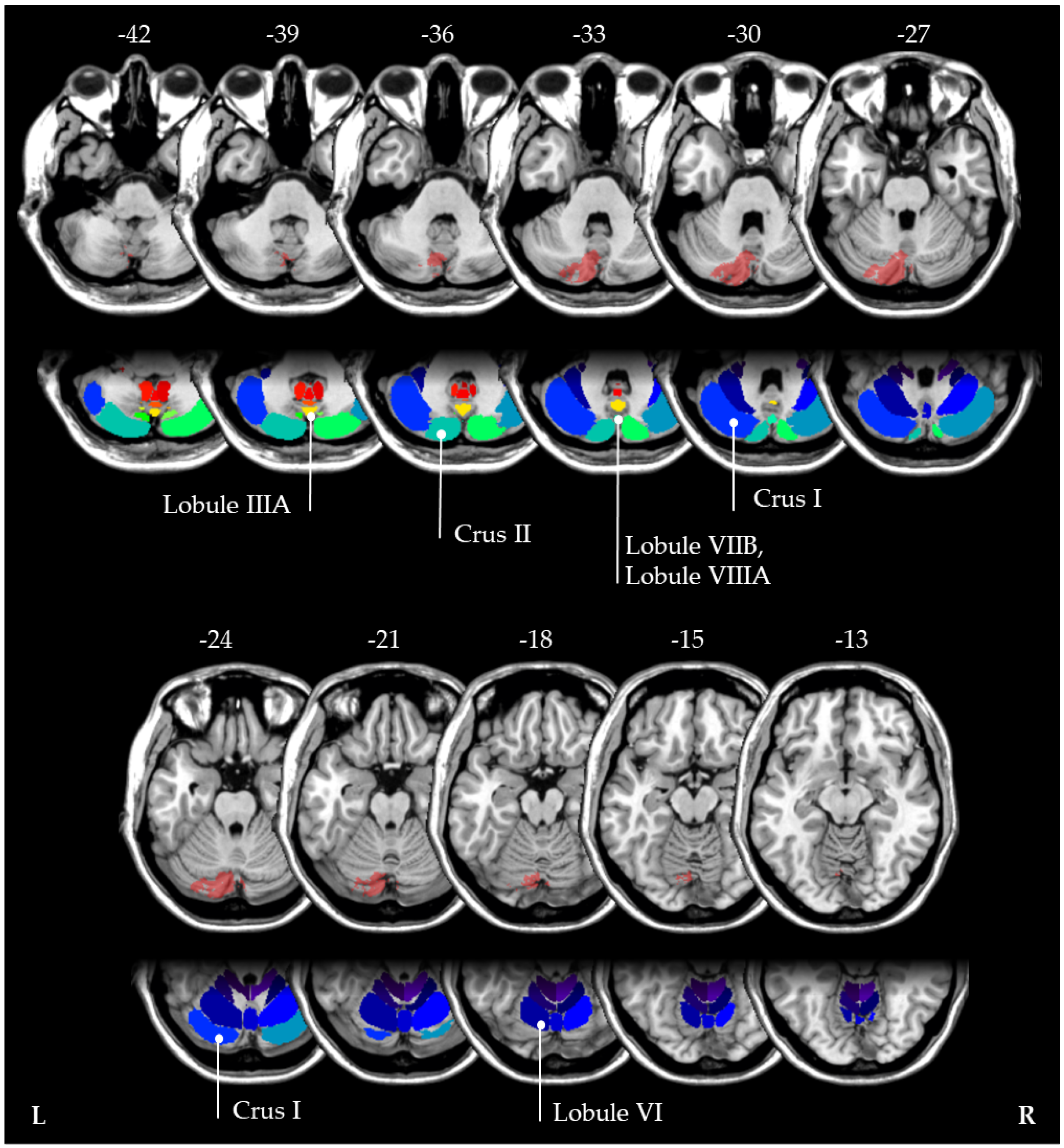 Brainsci 12 00290 g003