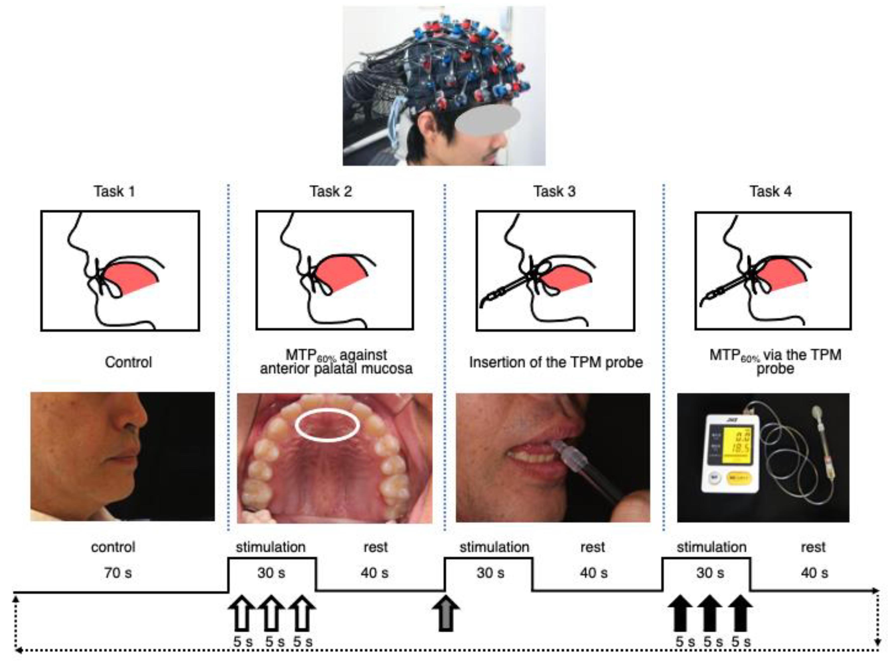 Brainsci 12 00296 g001