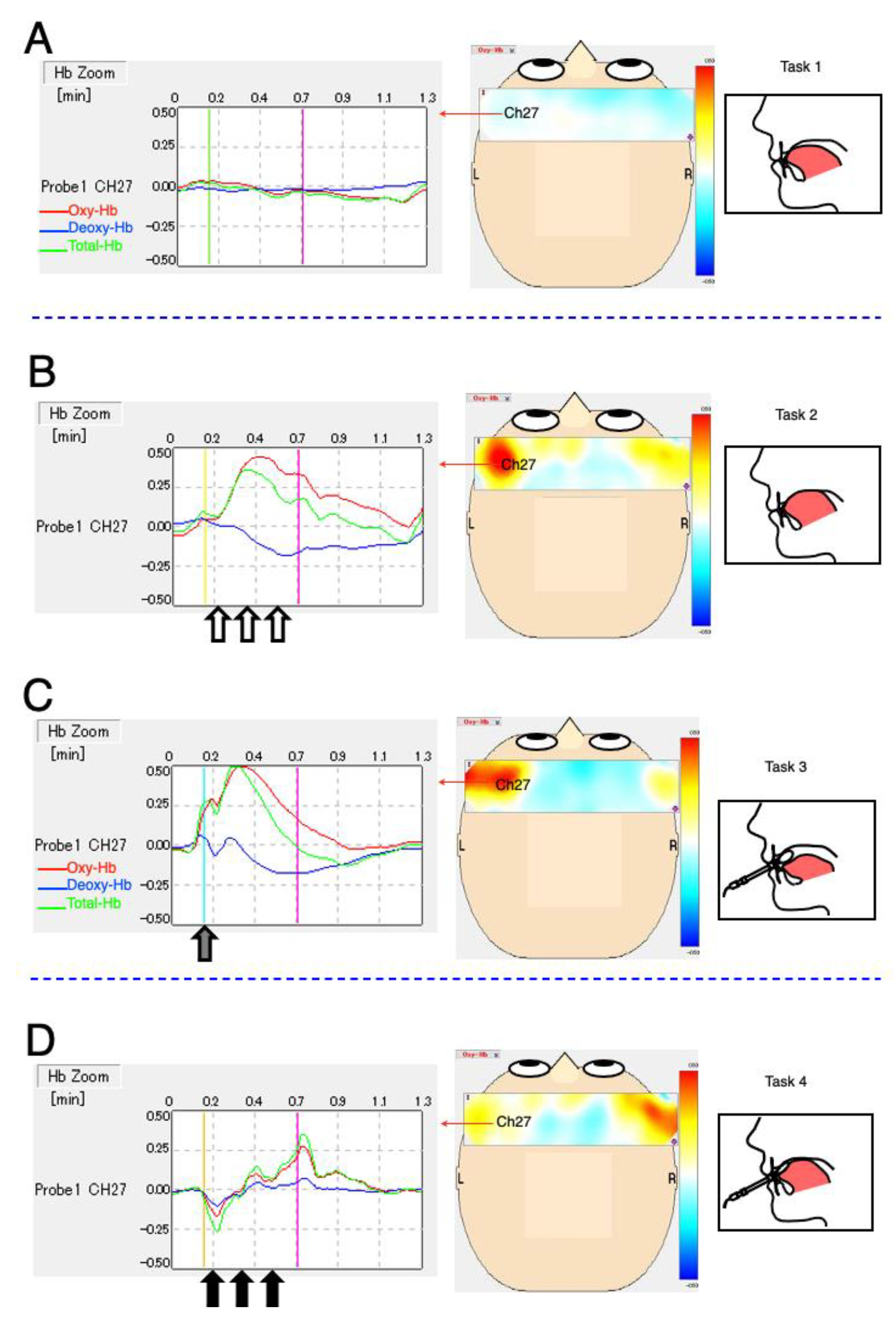 Brainsci 12 00296 g003