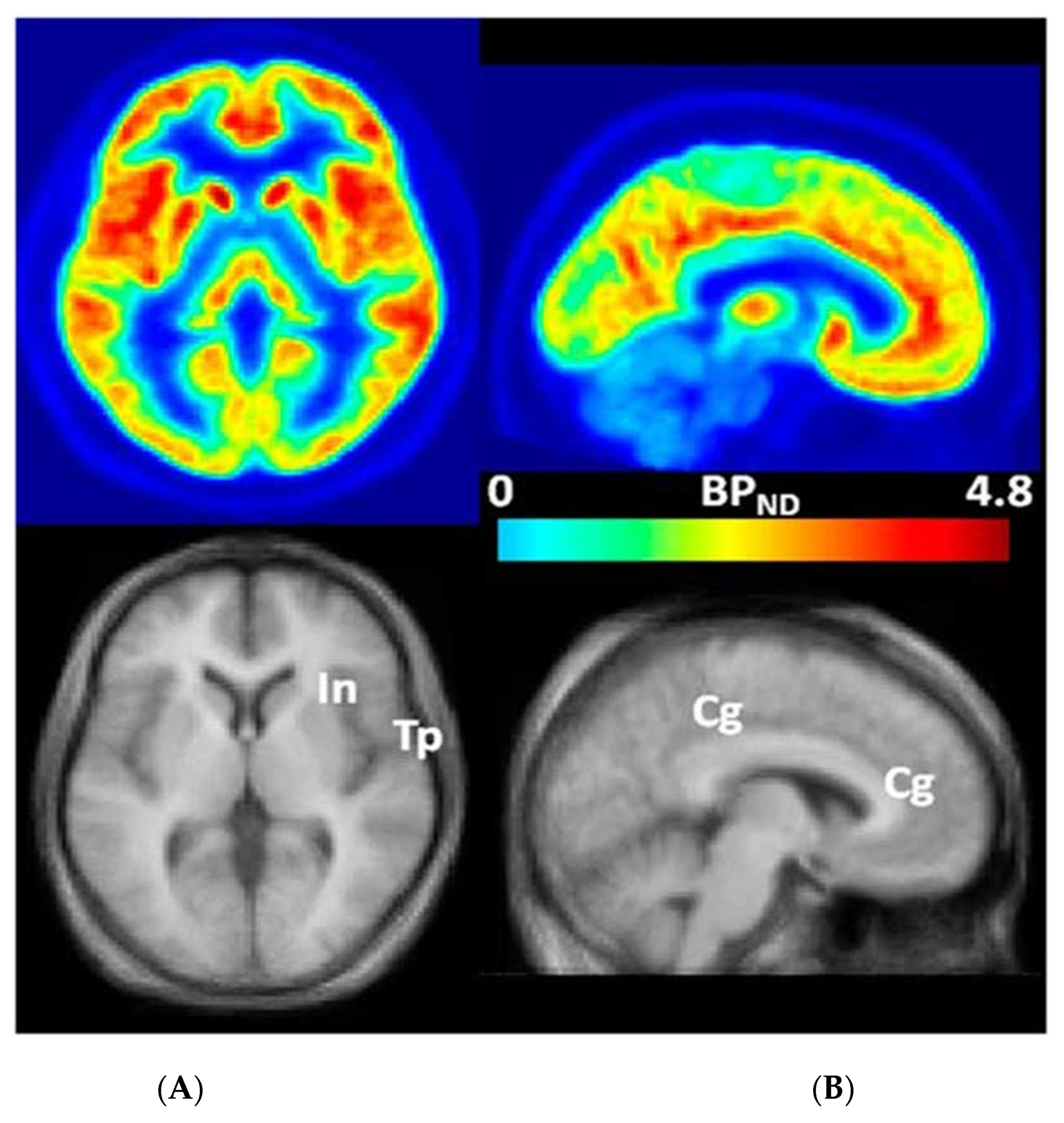 Brainsci 12 00314 g002