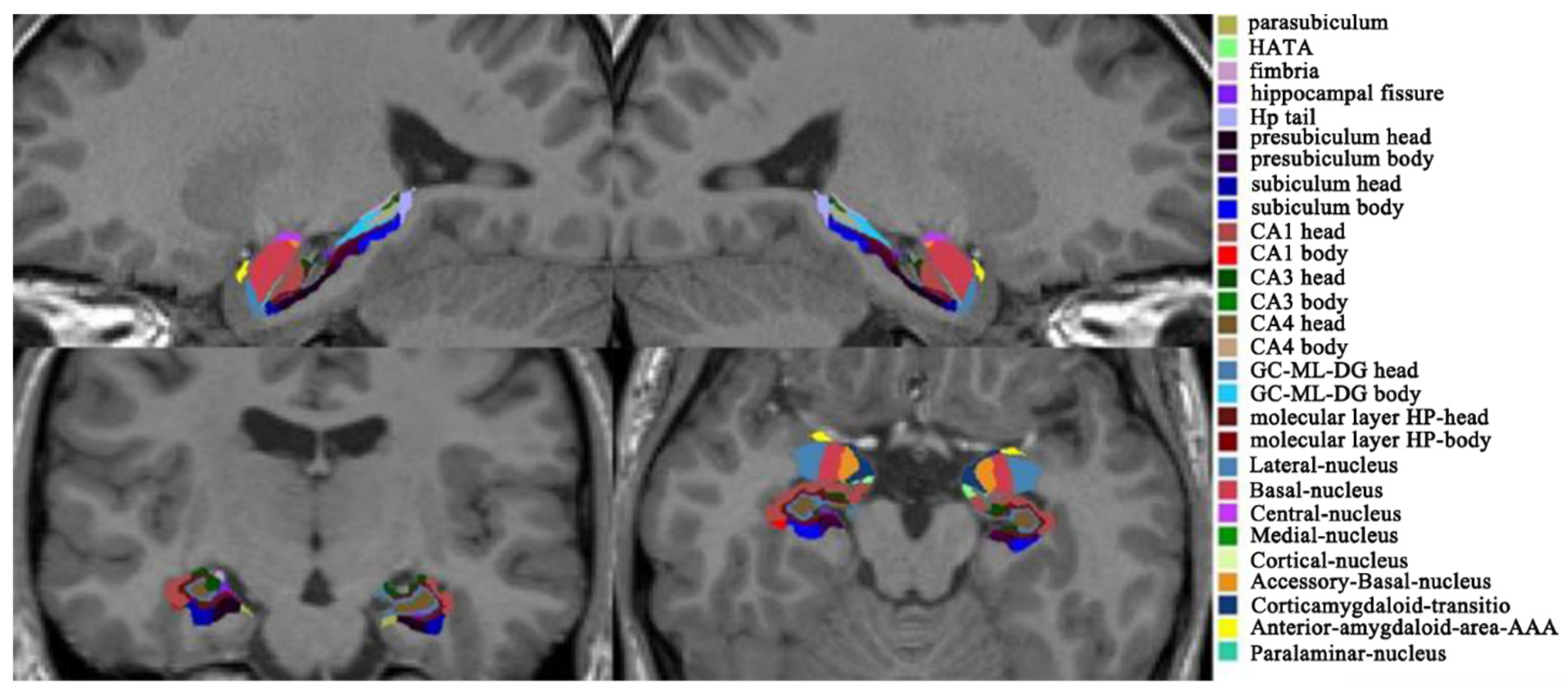 Brainsci 12 00359 g002