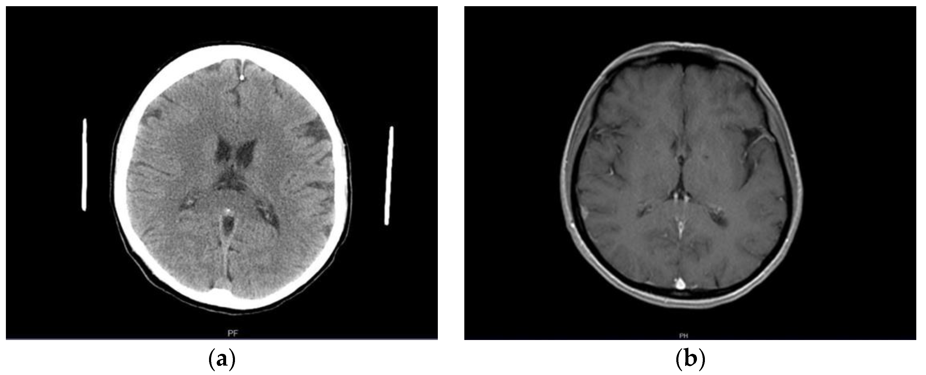 Brainsci 12 00384 g001